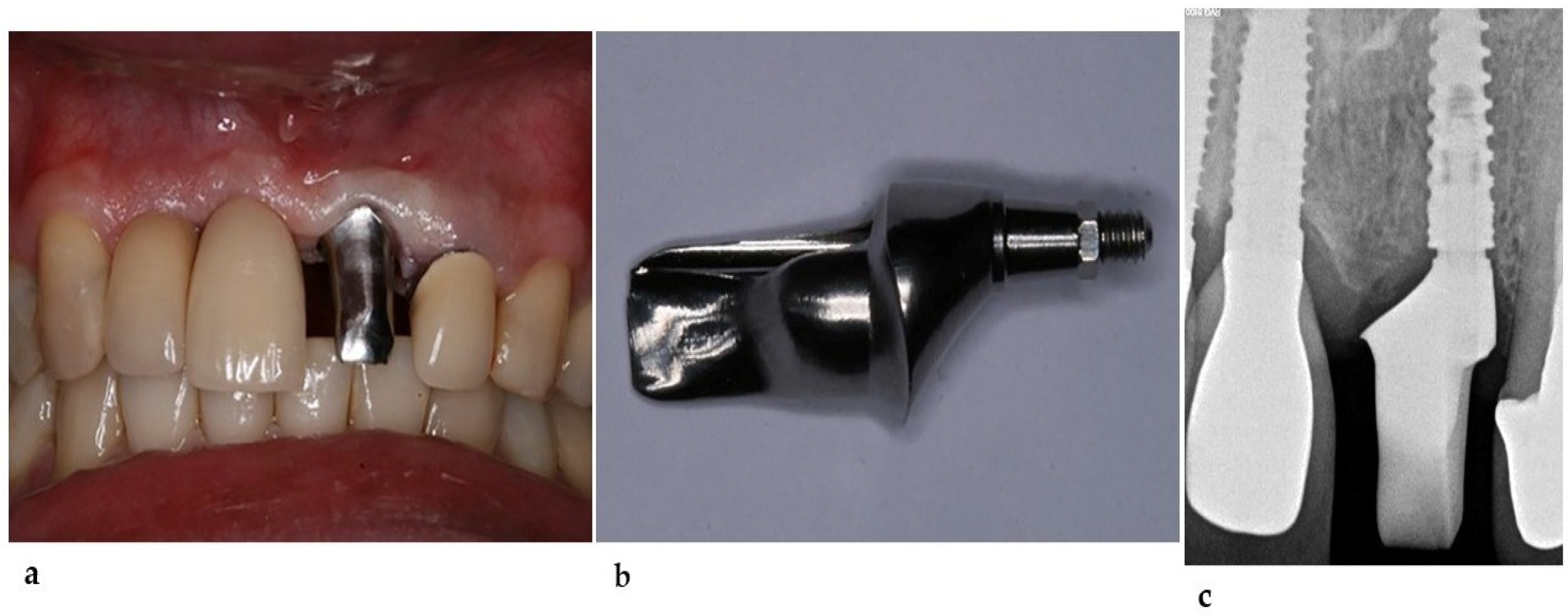 Healthcare 11 02472 g005 Healthcare 11 02472 g005