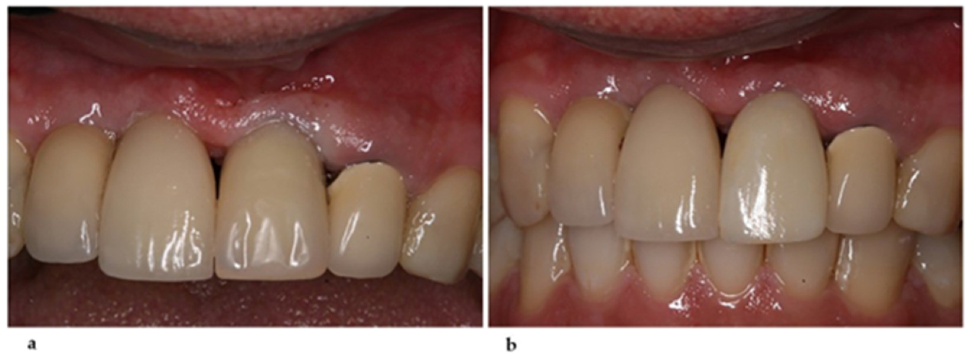 Healthcare 11 02472 g006 Healthcare 11 02472 g006