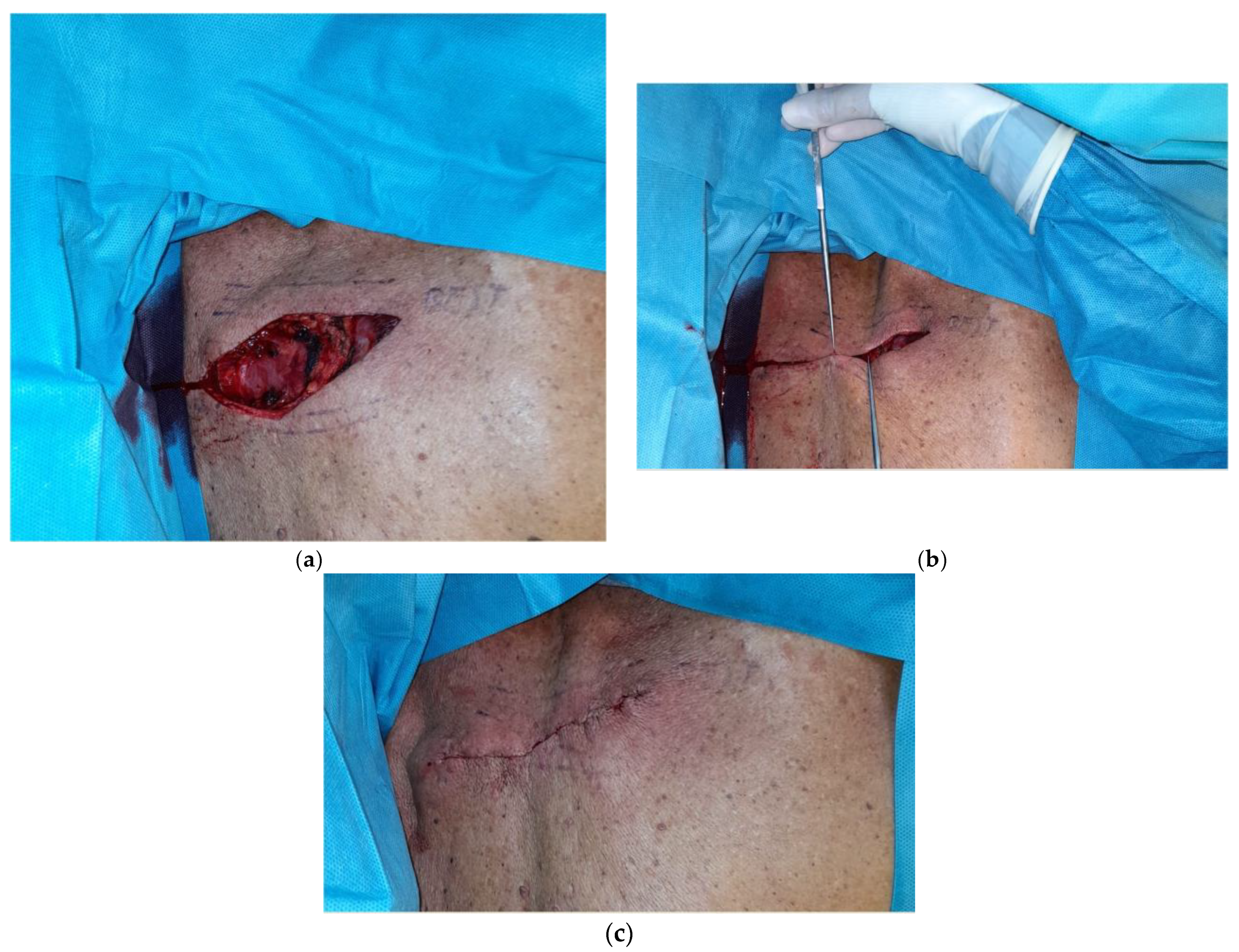 Healthcare 11 02624 g004