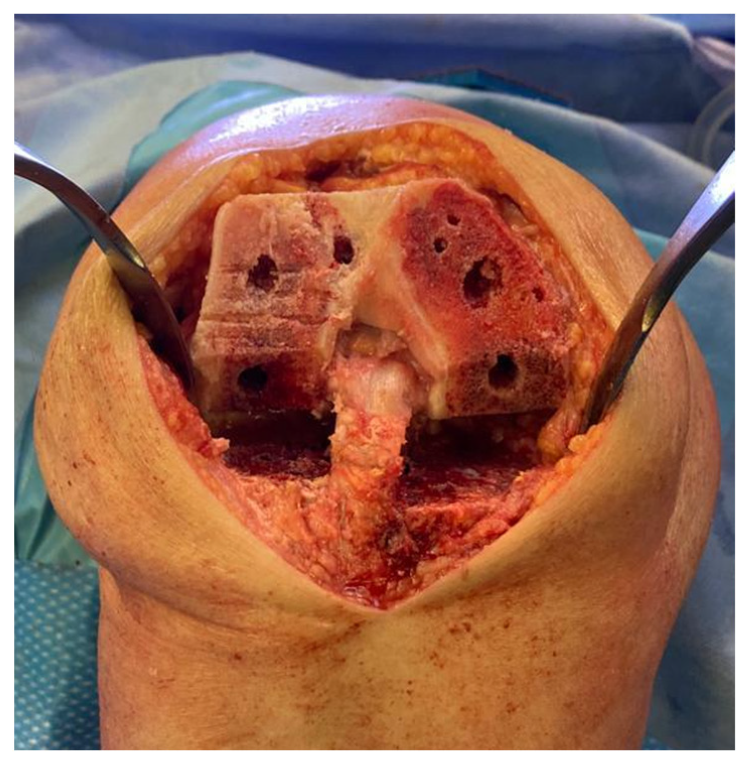 Healthcare 11 02999 g003 Healthcare 11 02999 g003