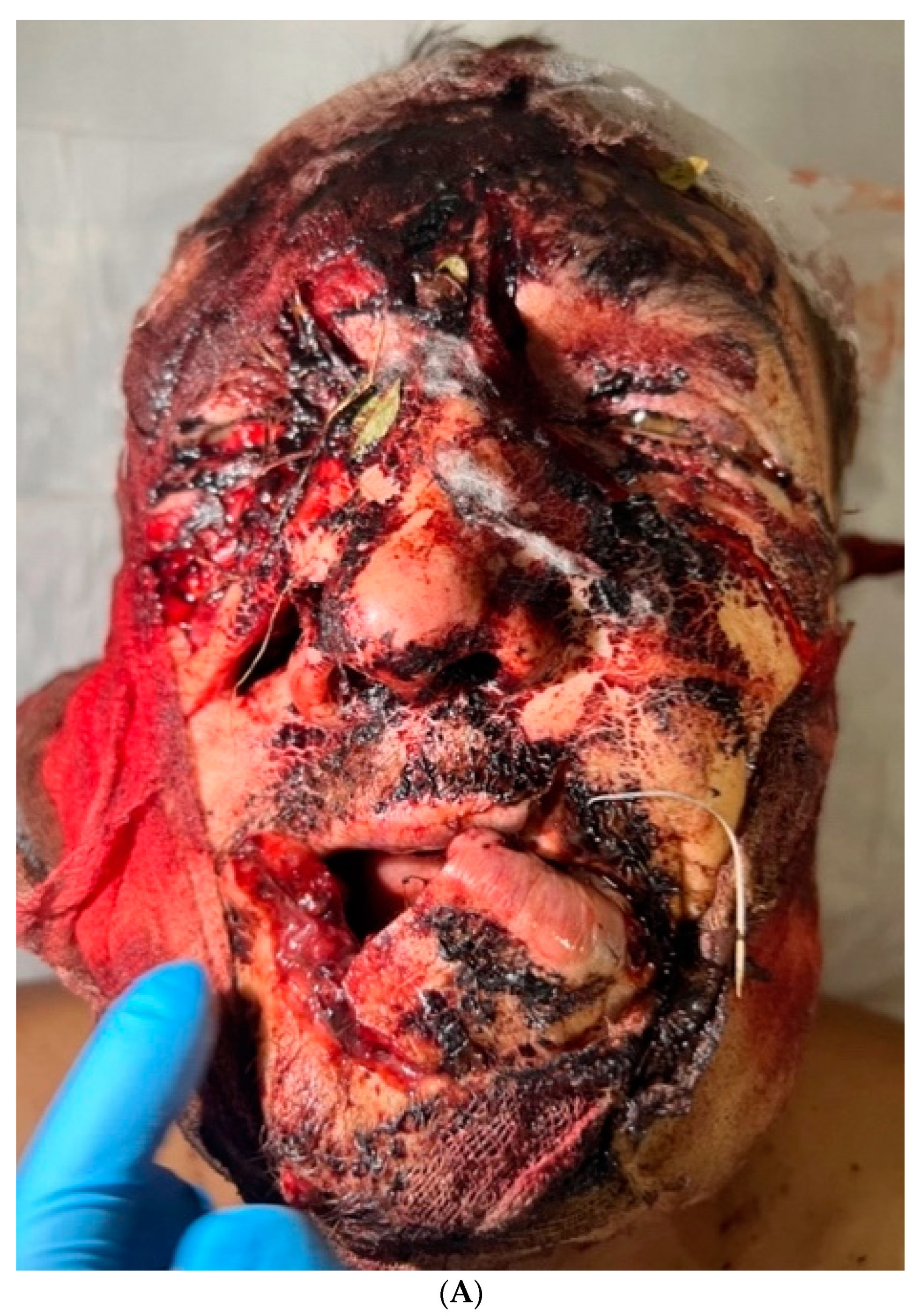 Healthcare 12 00542 g001a