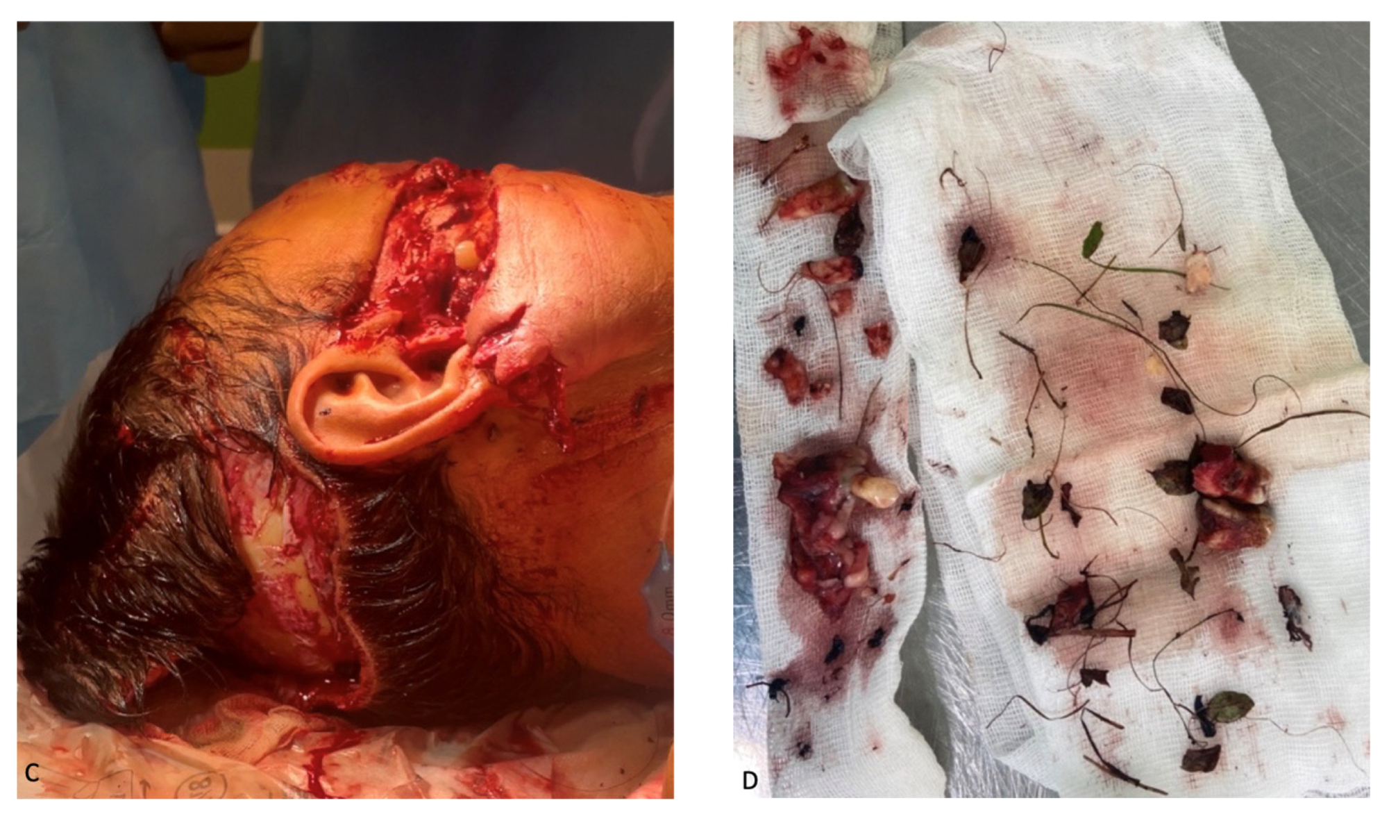 Healthcare 12 00542 g002b