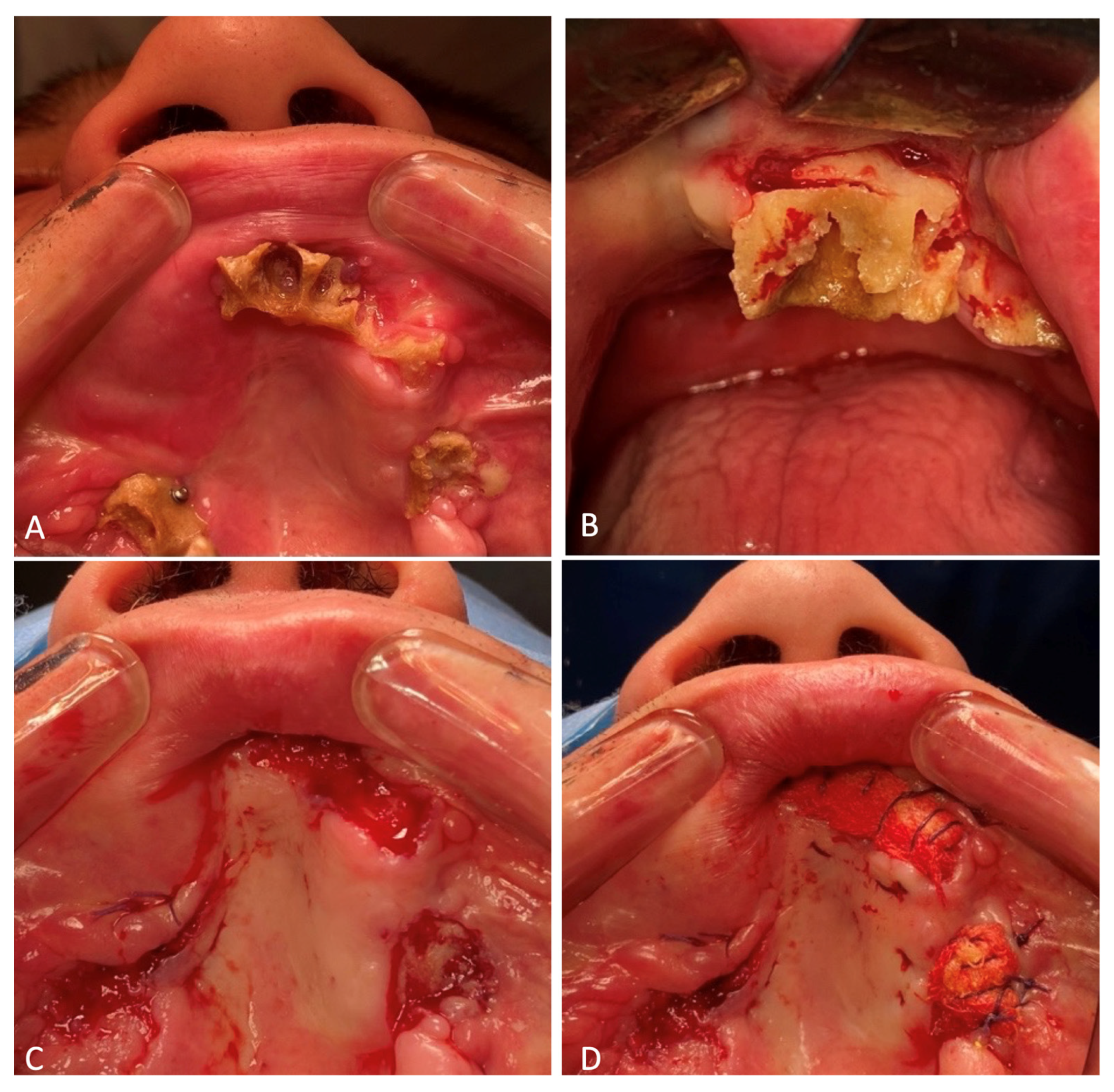 Healthcare 12 00542 g010