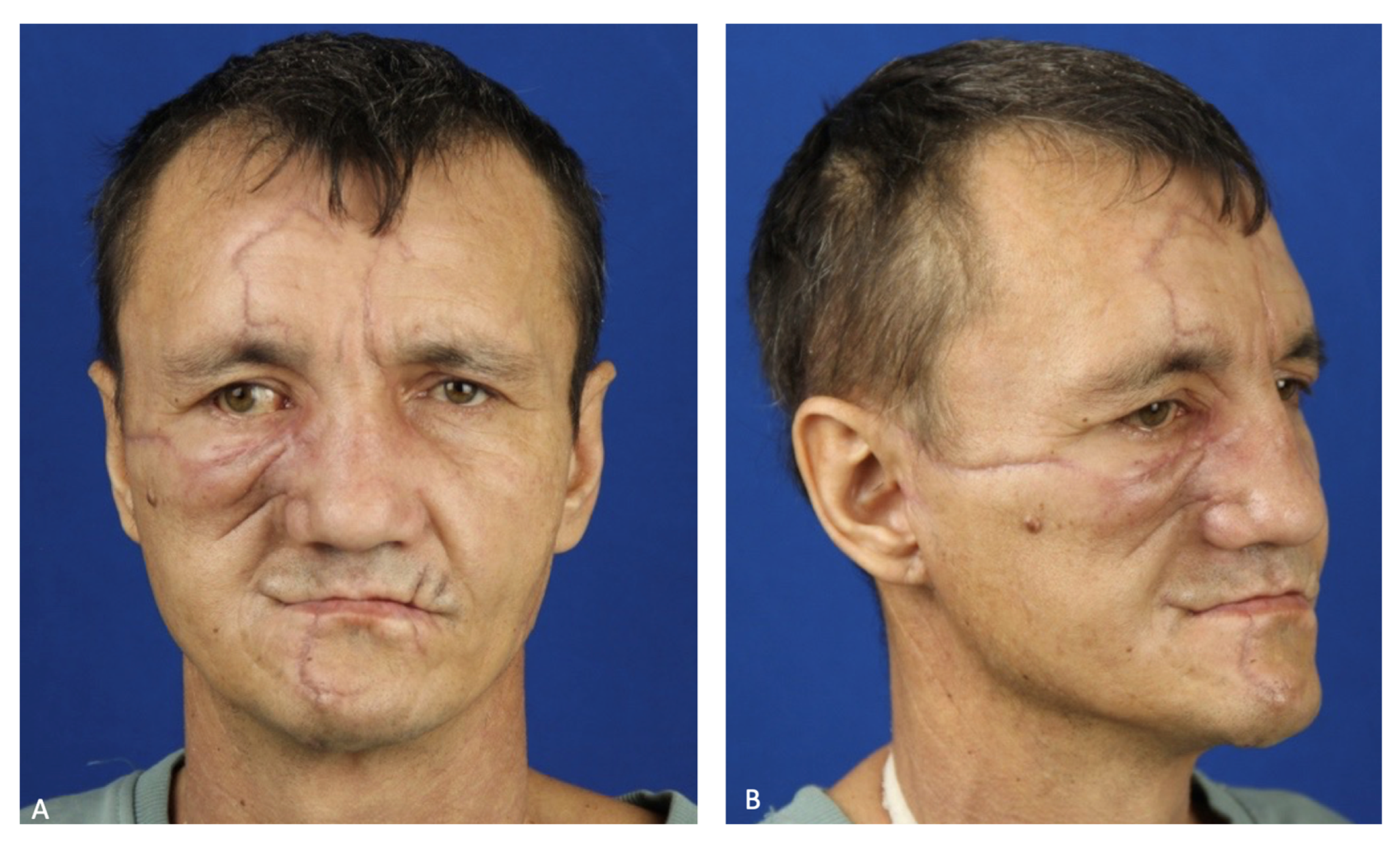 Healthcare 12 00542 g011