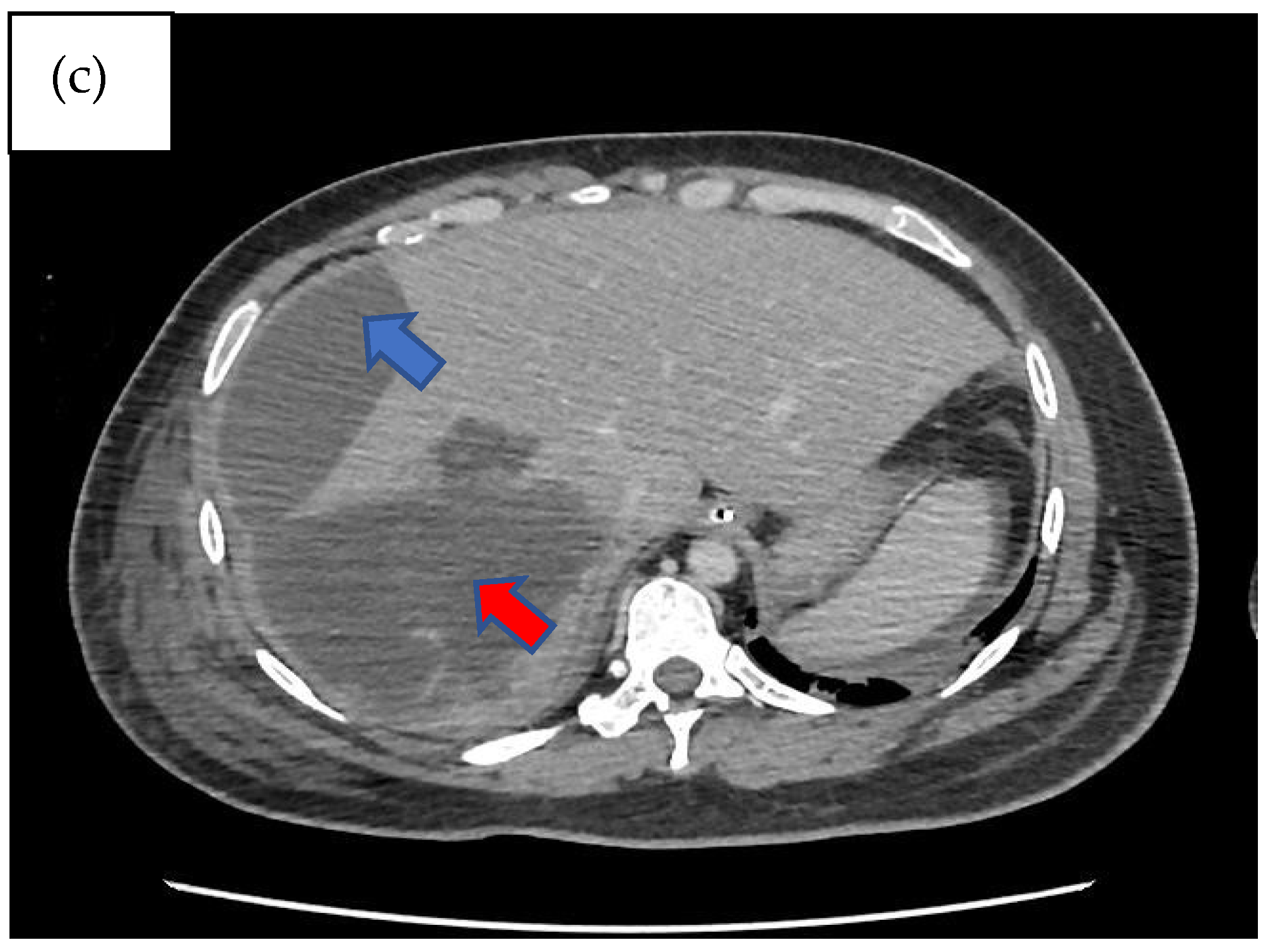 Healthcare 12 00880 g001b