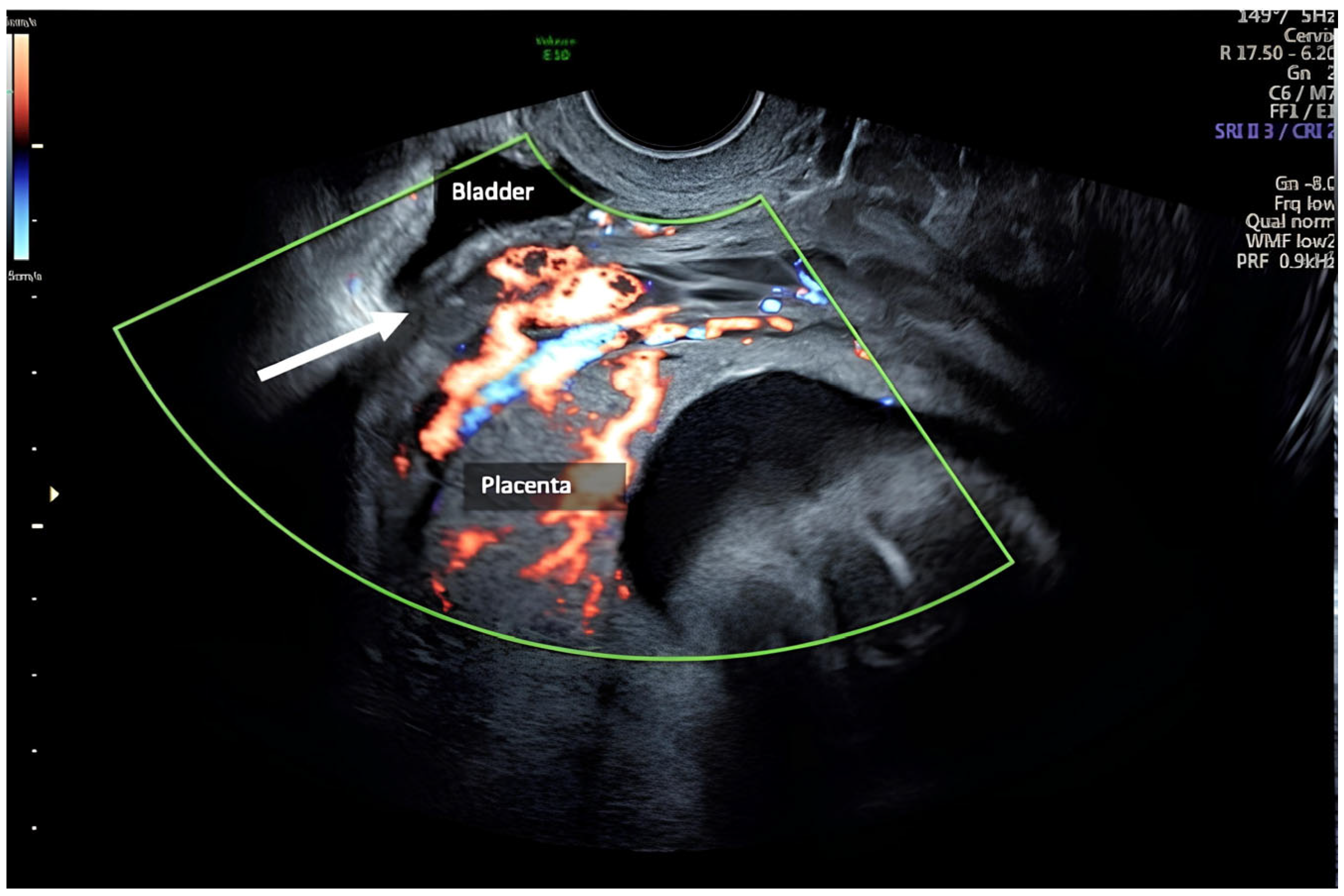 Healthcare 12 00988 g004