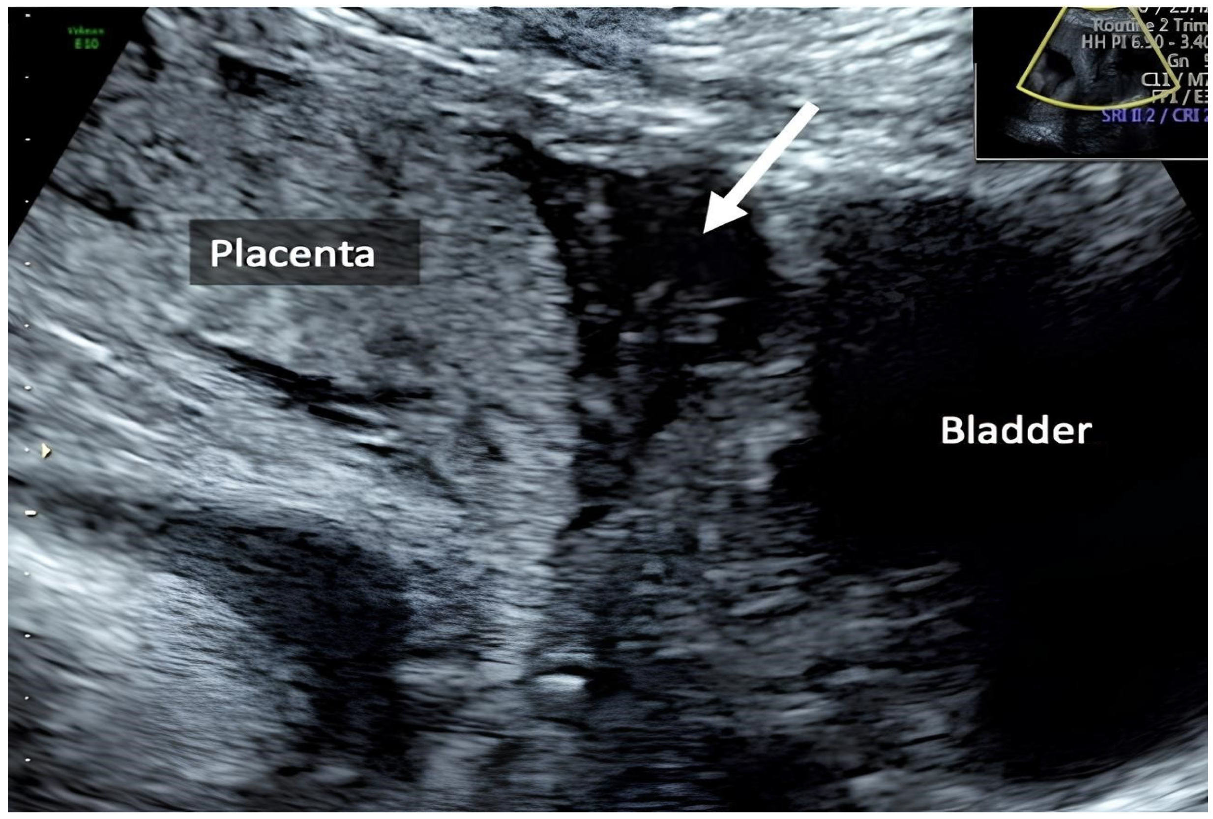 Healthcare 12 00988 g005