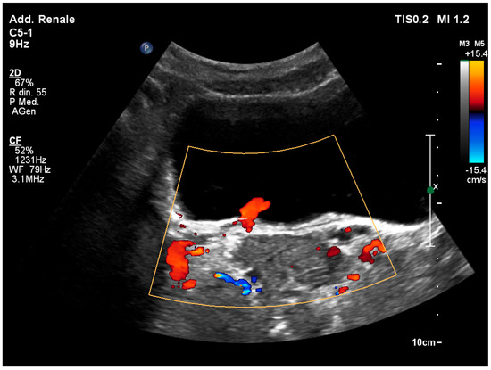 健康・医学 ATLAS OF Renal Ultrasonography O'NEILL Atlas of Renal Ultrasonography: 9780721689135: Medicine
