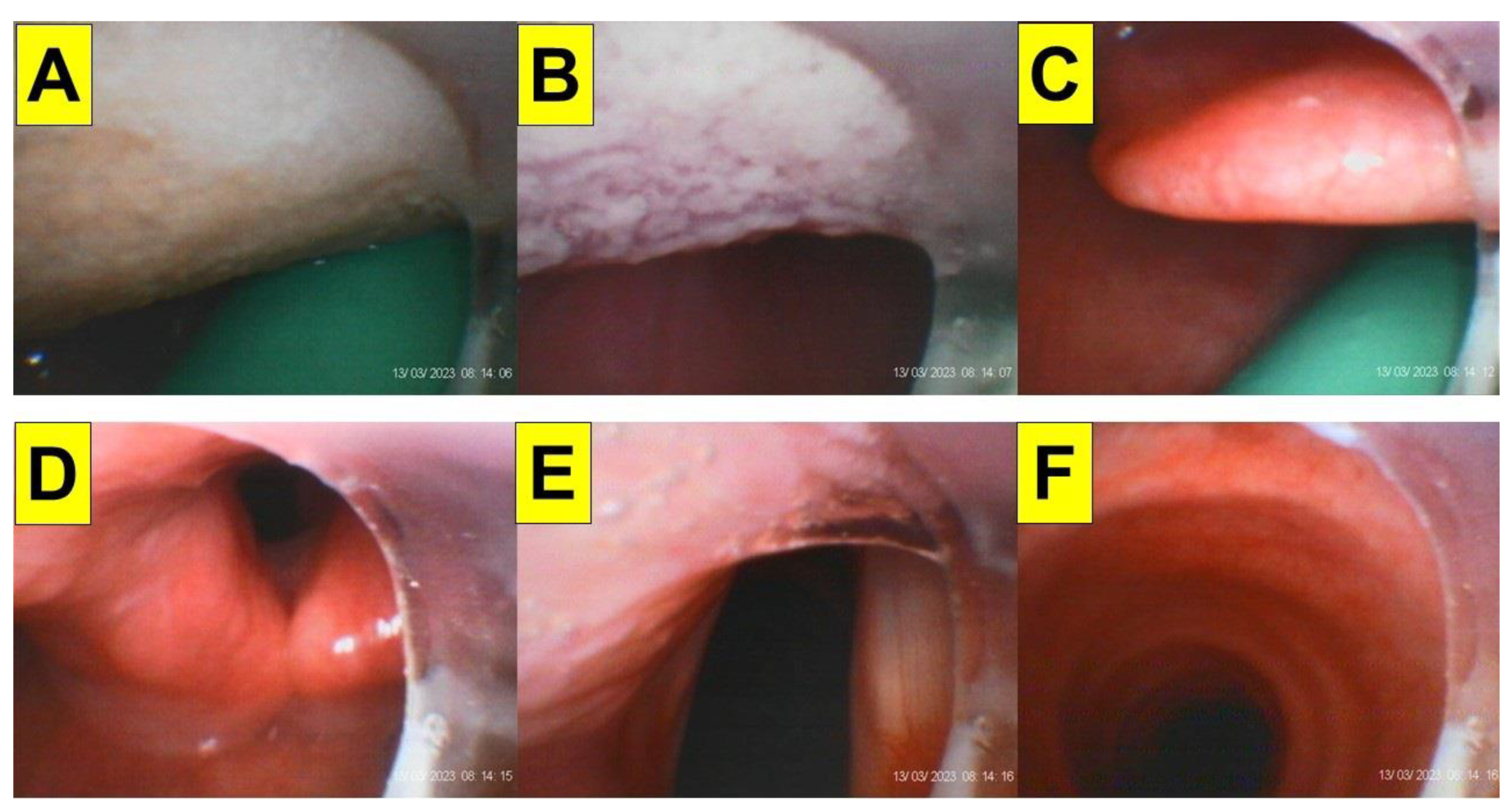 Healthcare 12 01404 g008