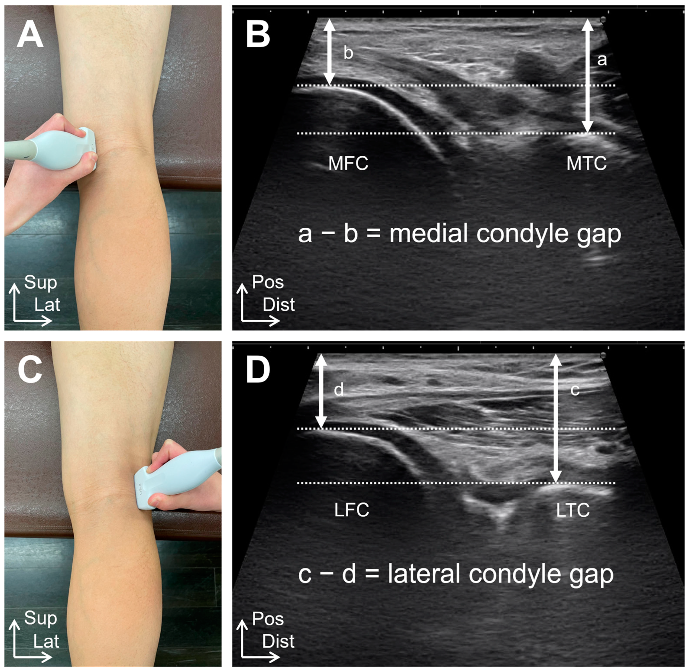 Relationship Between the Sagittal and Coronary Alignment of