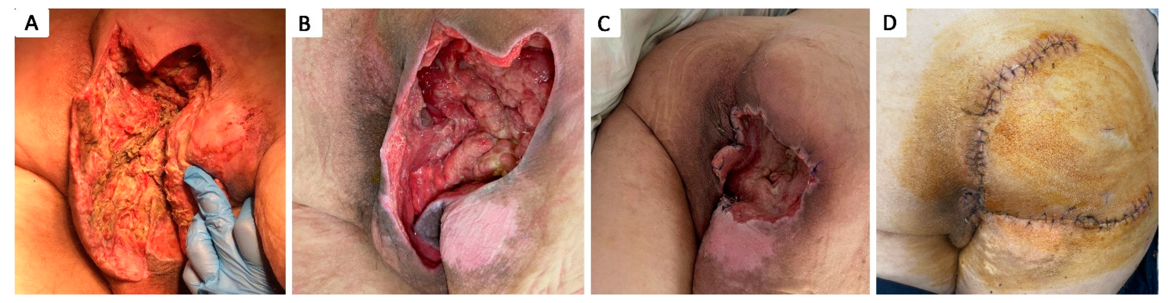 Healthcare 12 02583 g007 Healthcare 12 02583 g007