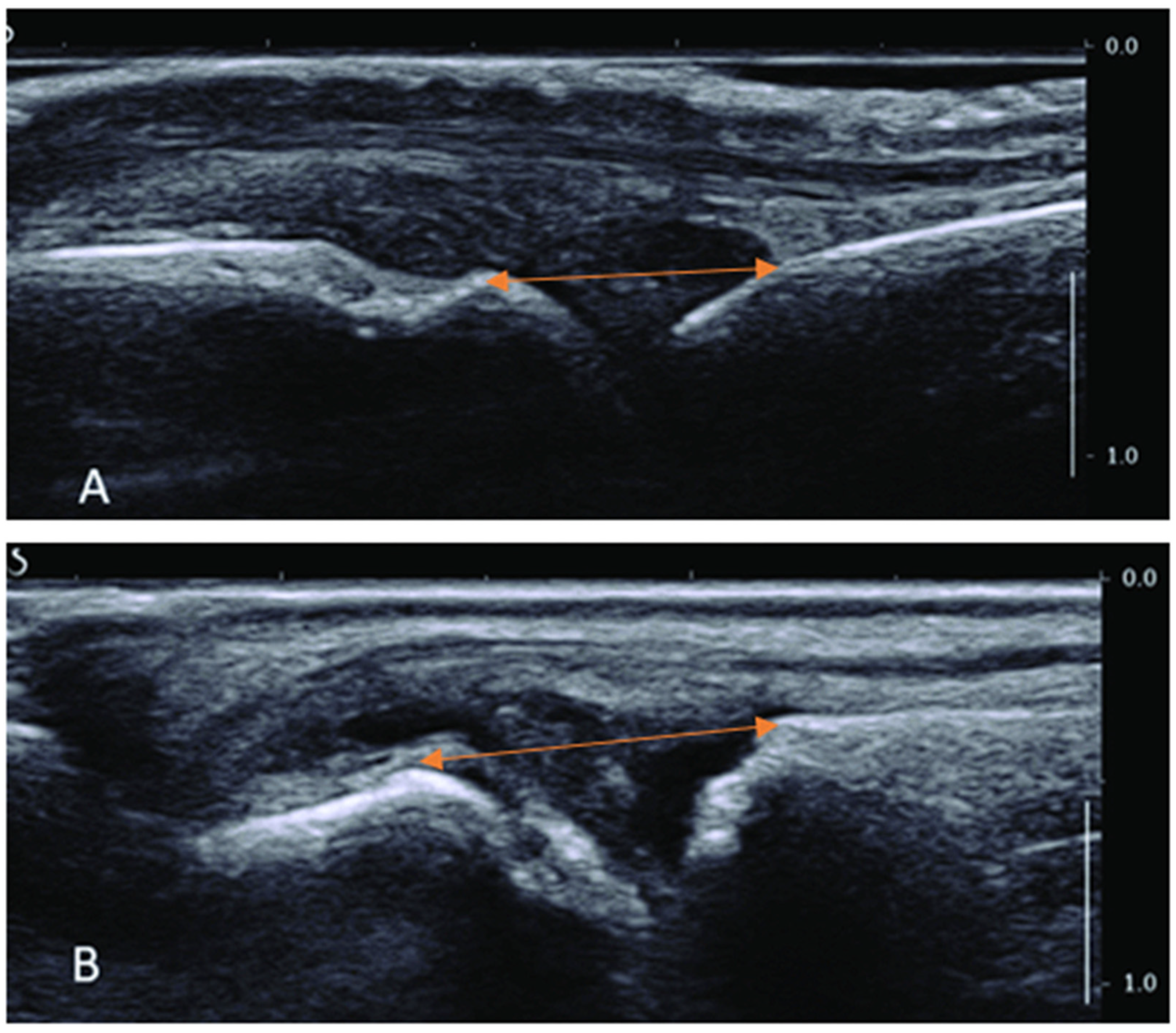 Healthcare 13 00554 g003 Healthcare 13 00554 g003