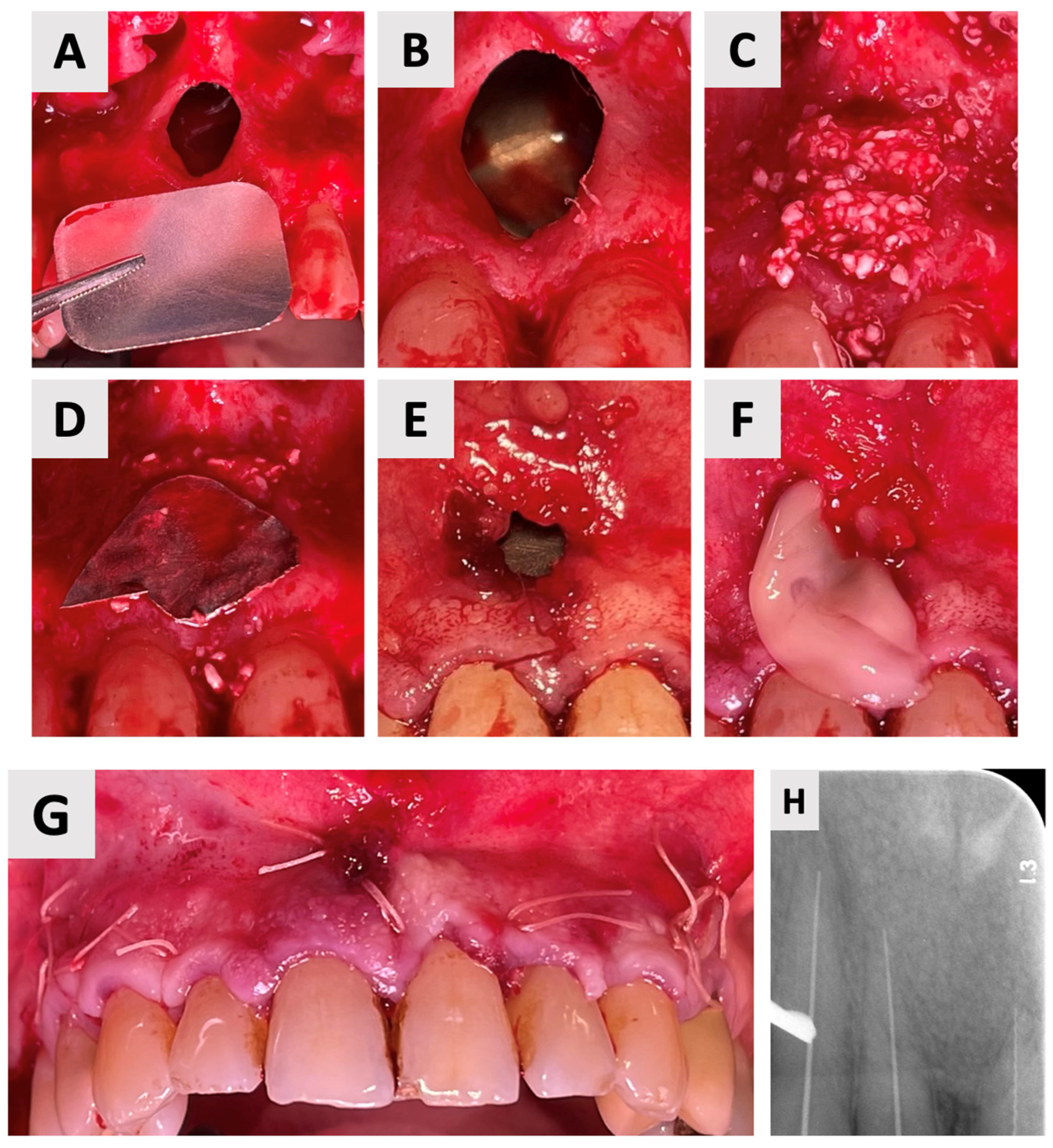 Healthcare 13 01068 g004