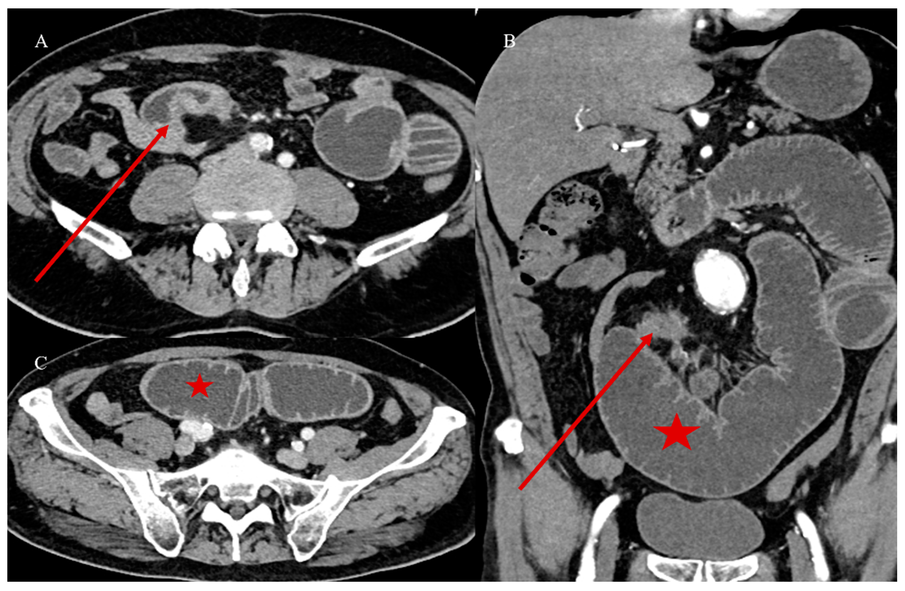 Healthcare 13 01071 g011
