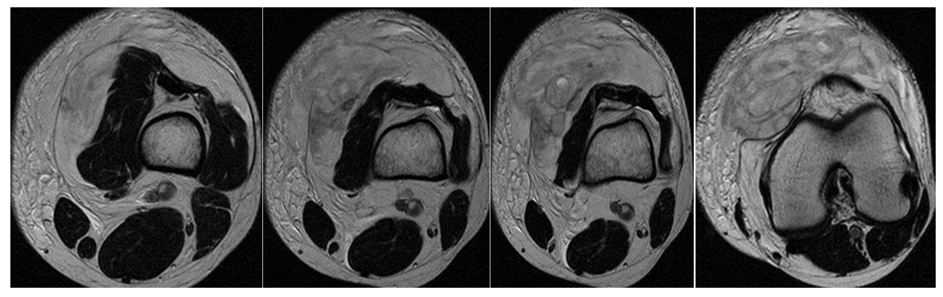 Healthcare 13 01303 g002