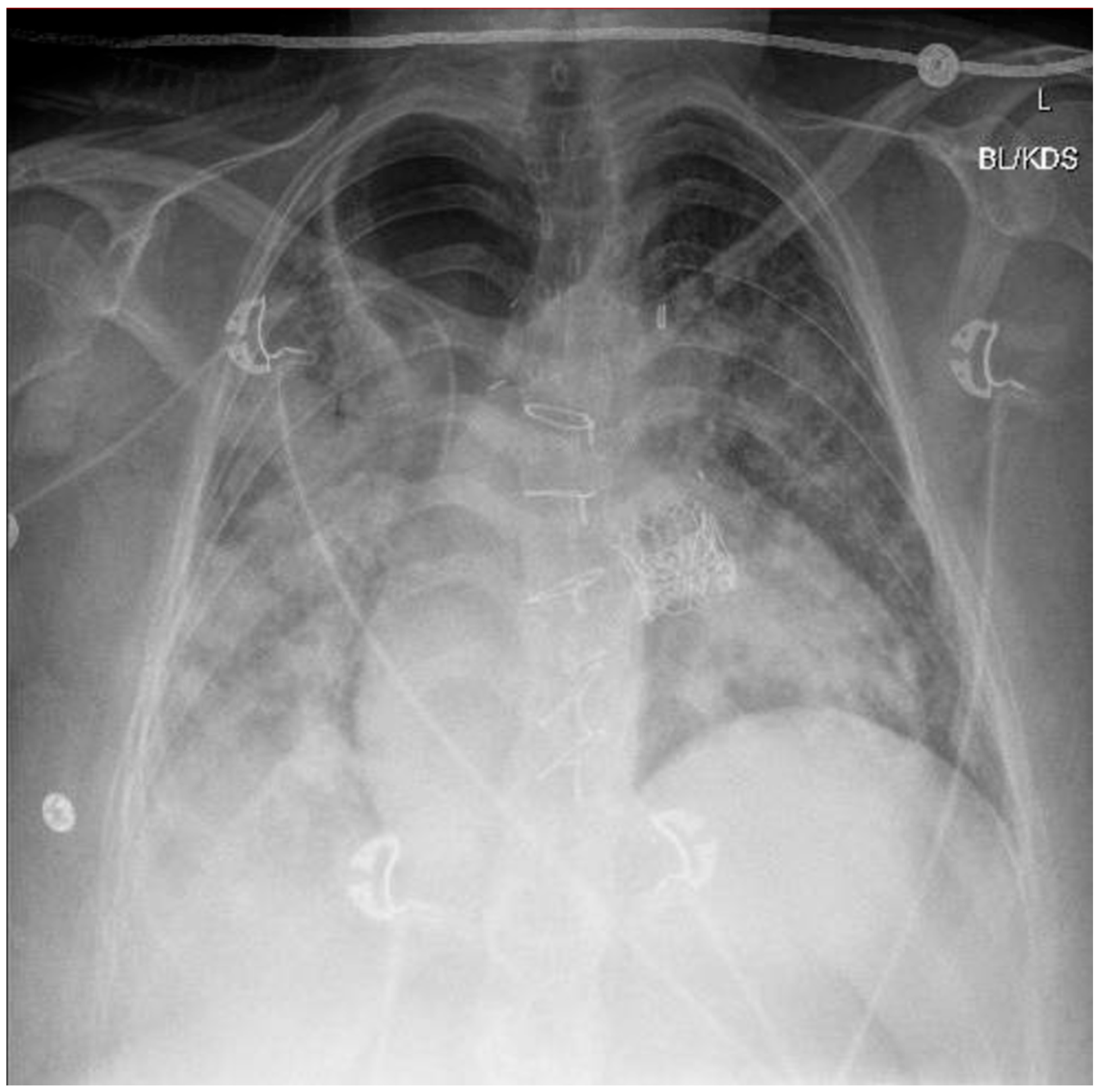 Healthcare 13 01361 g001