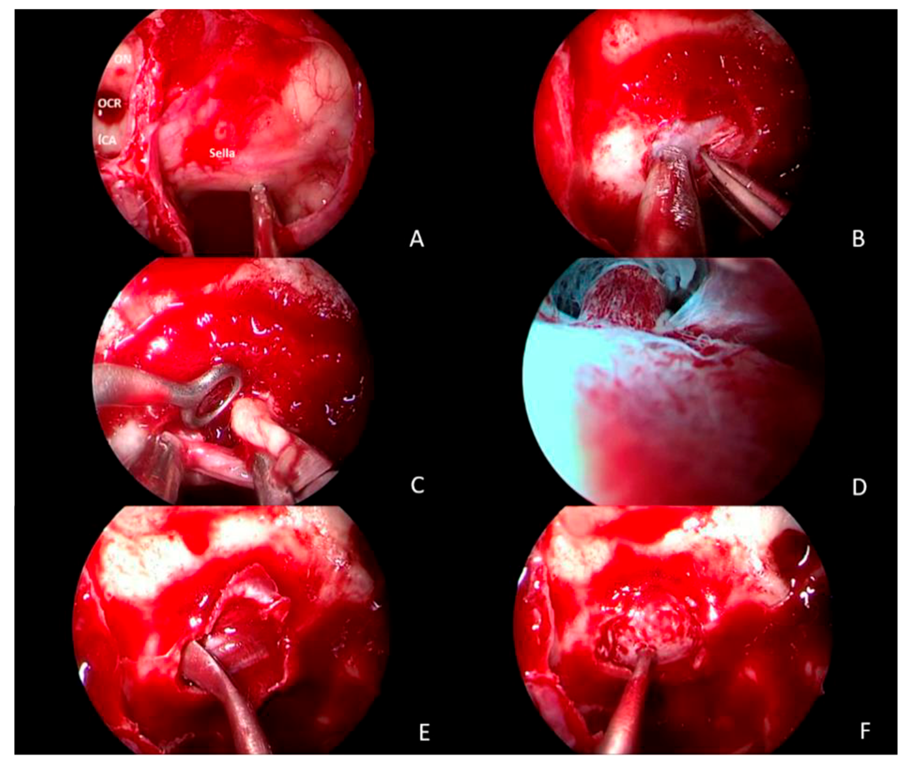 Healthcare 13 01395 g001
