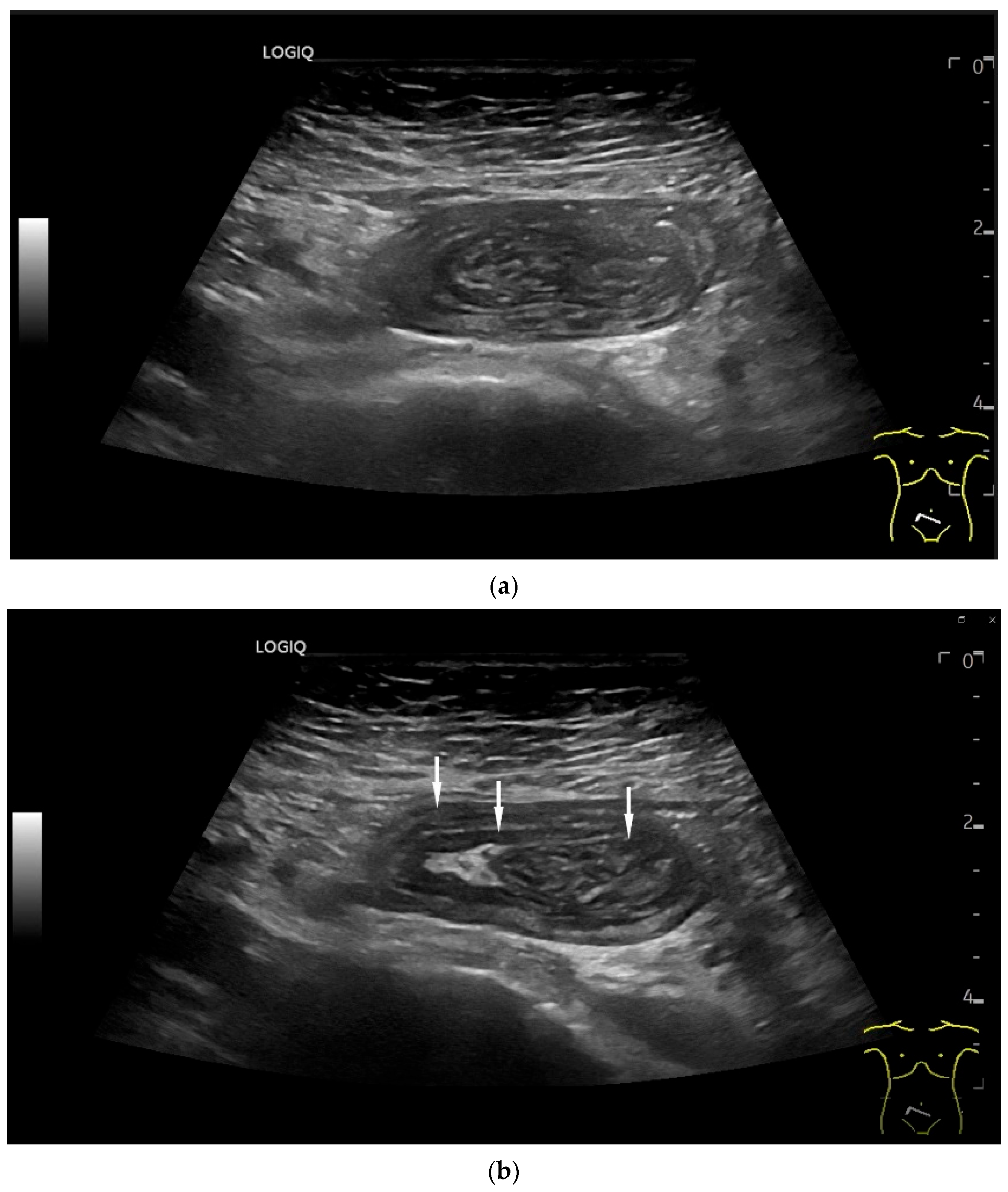 Healthcare 13 02776 g003 Healthcare 13 02776 g003