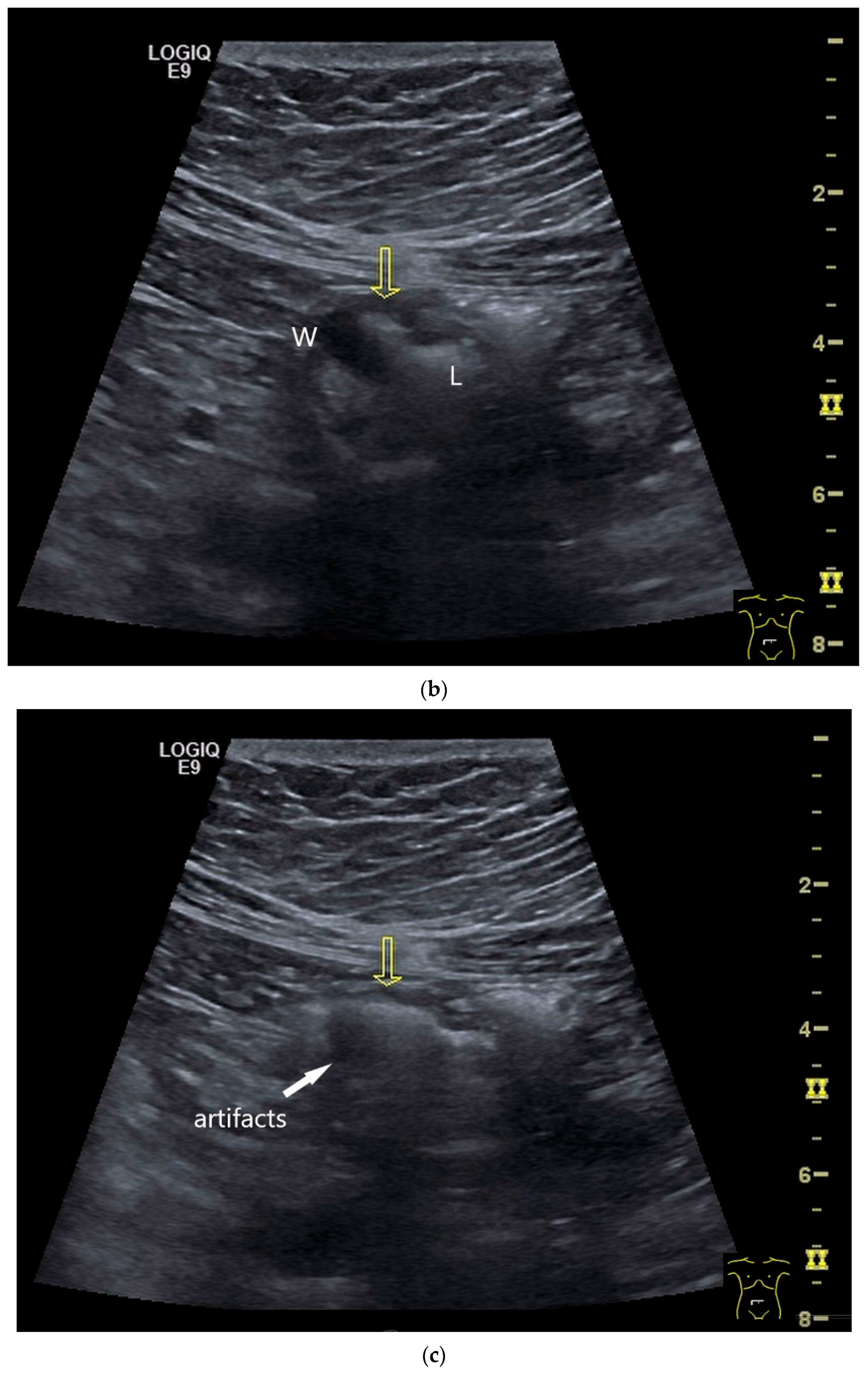 Healthcare 13 02776 g004b Healthcare 13 02776 g004b