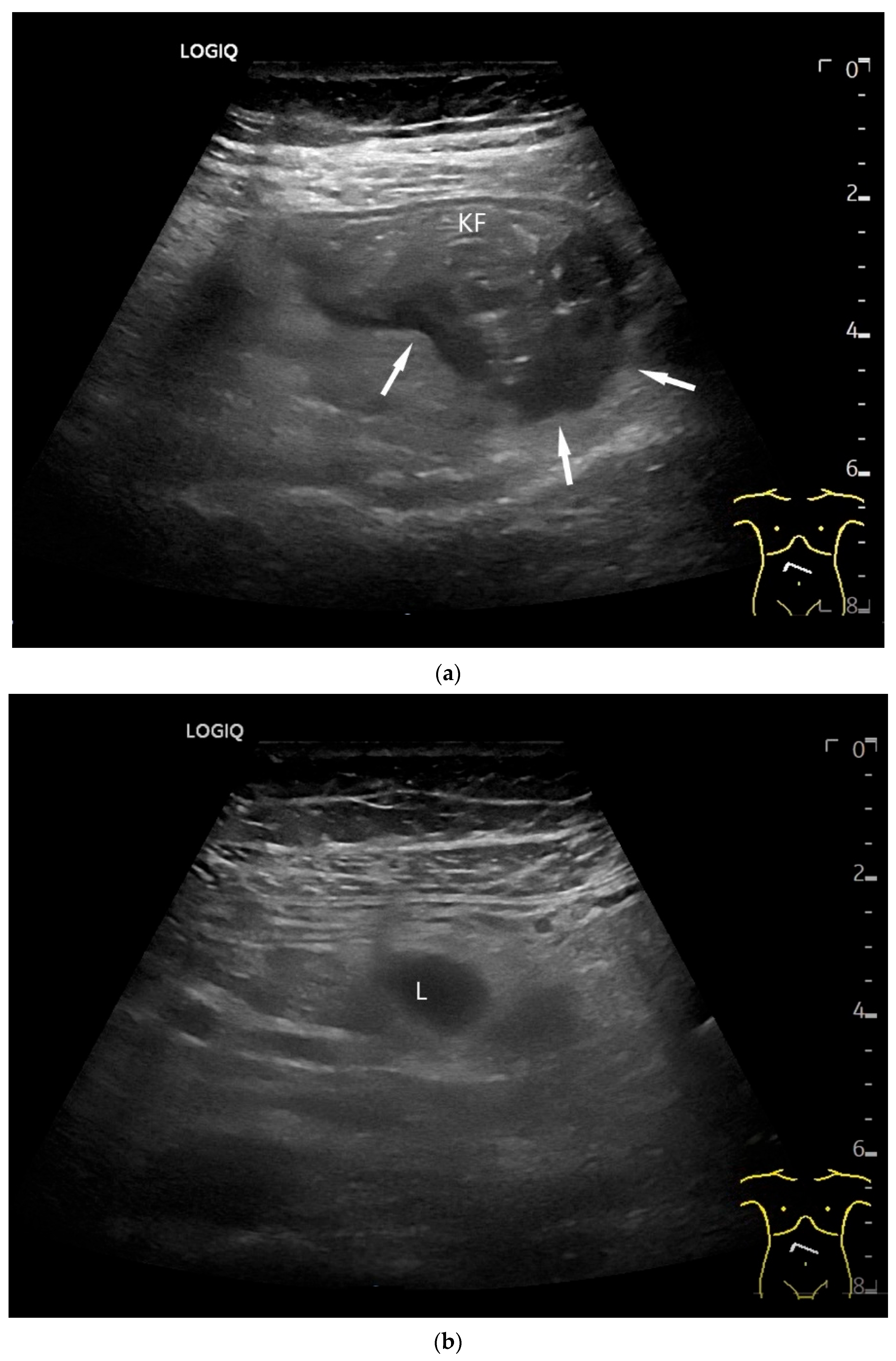 Healthcare 13 02776 g006 Healthcare 13 02776 g006
