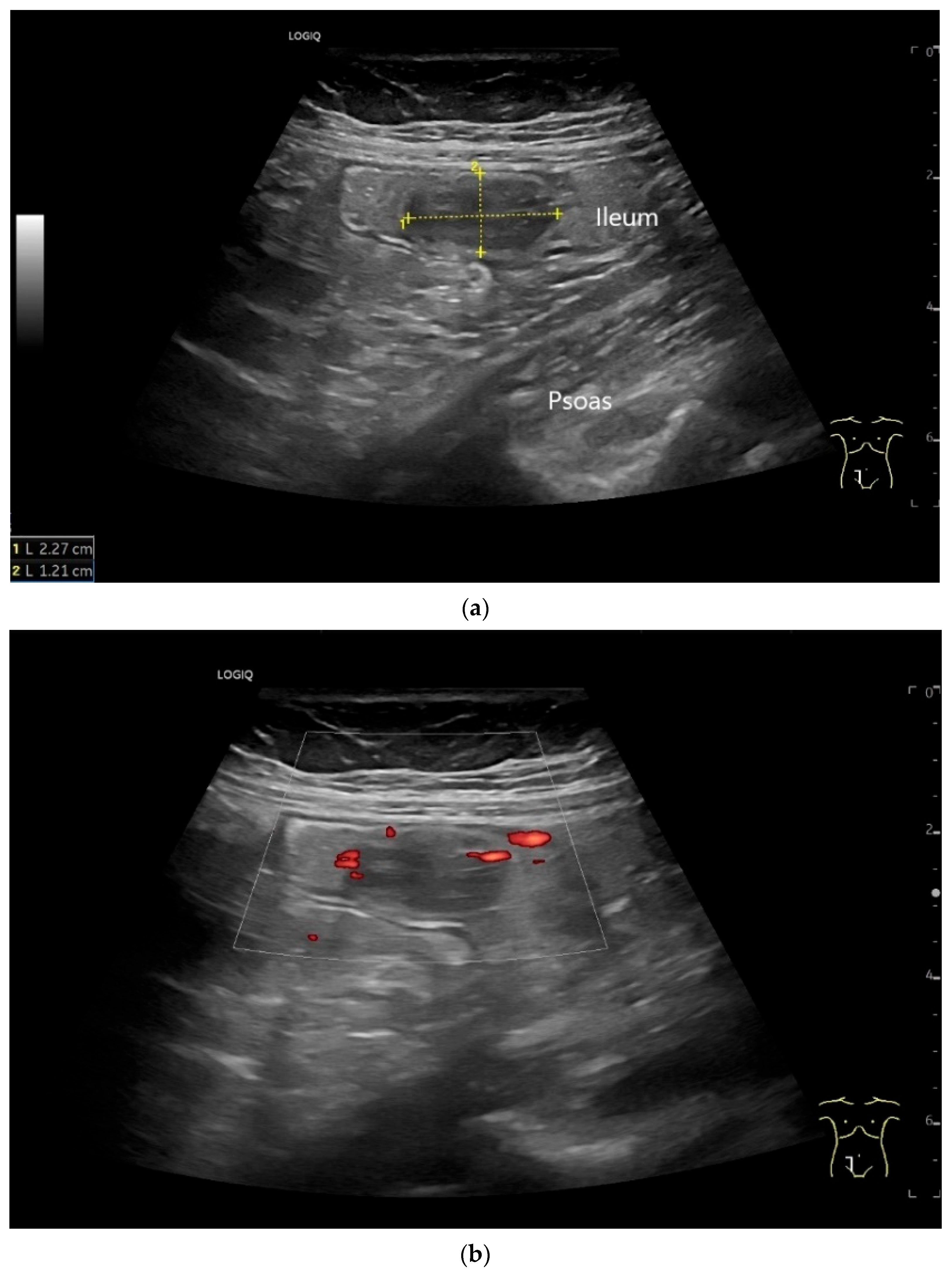 Healthcare 13 02776 g007a Healthcare 13 02776 g007a