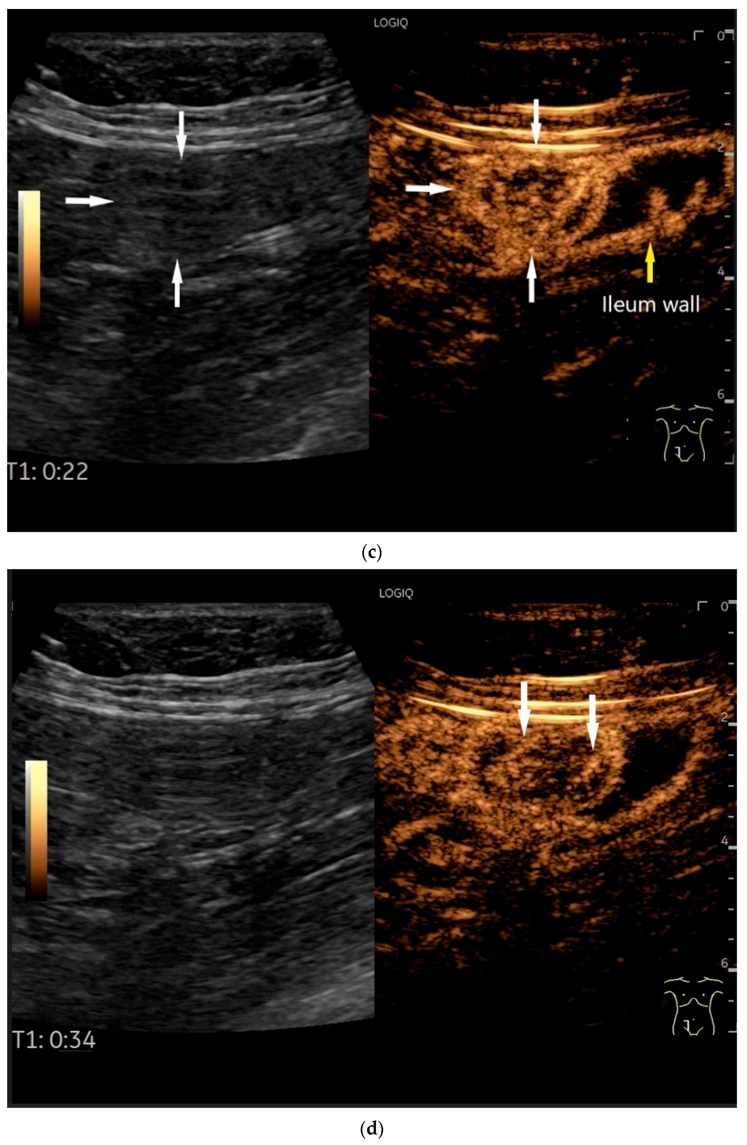 Healthcare 13 02776 g007b Healthcare 13 02776 g007b