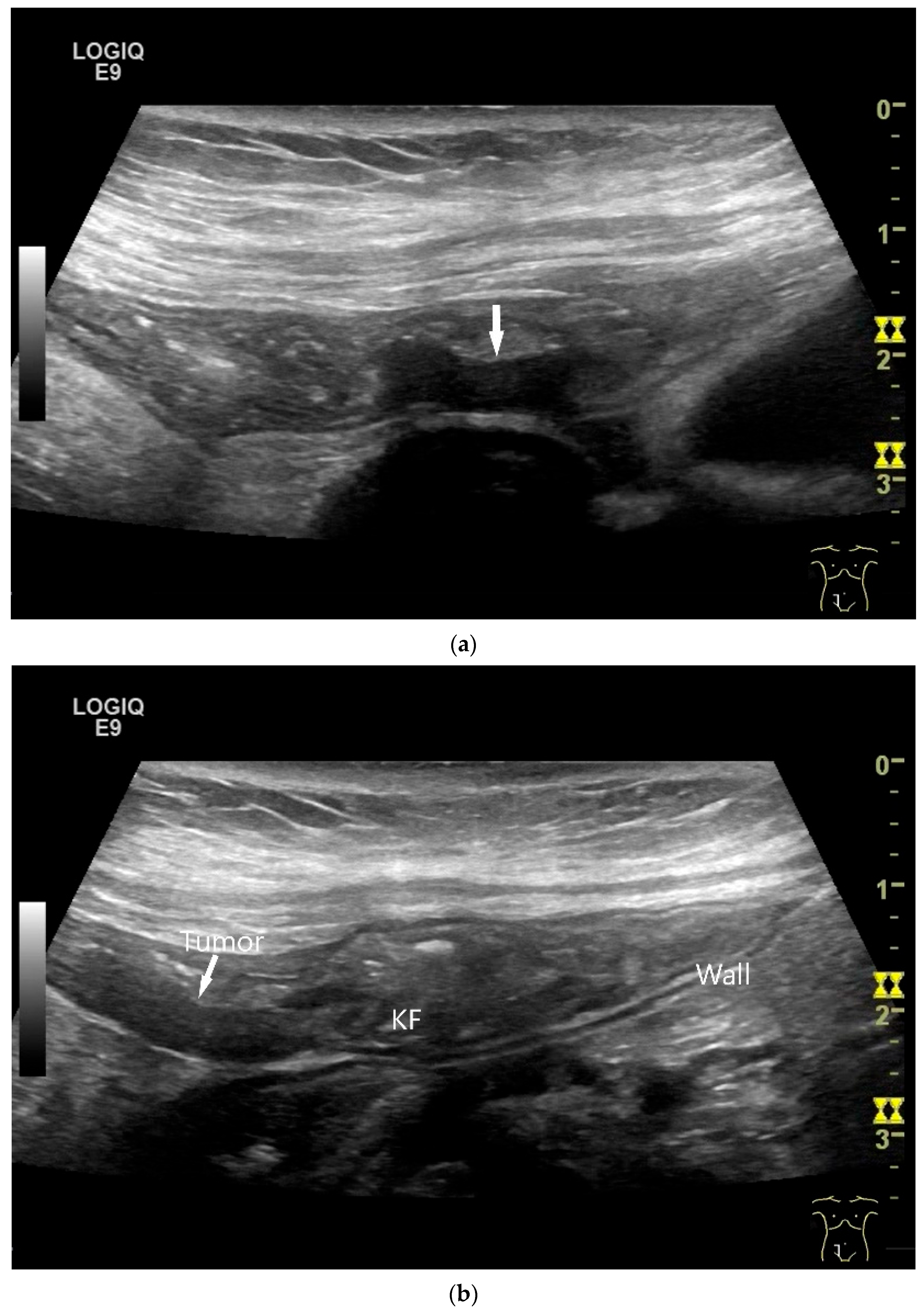 Healthcare 13 02776 g008a Healthcare 13 02776 g008a