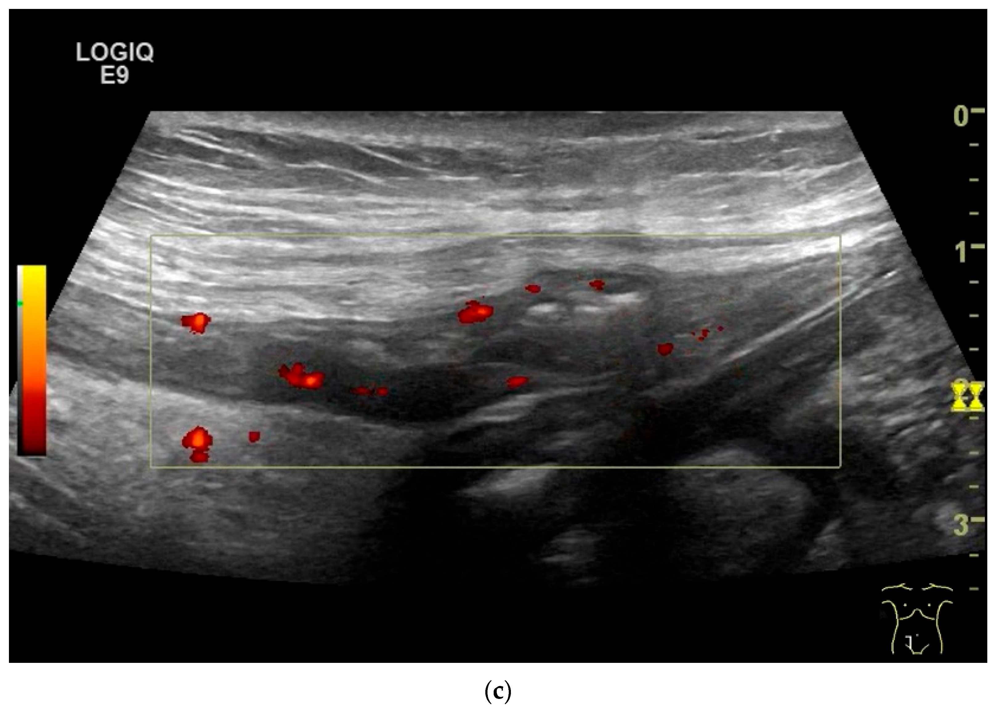 Healthcare 13 02776 g008b Healthcare 13 02776 g008b