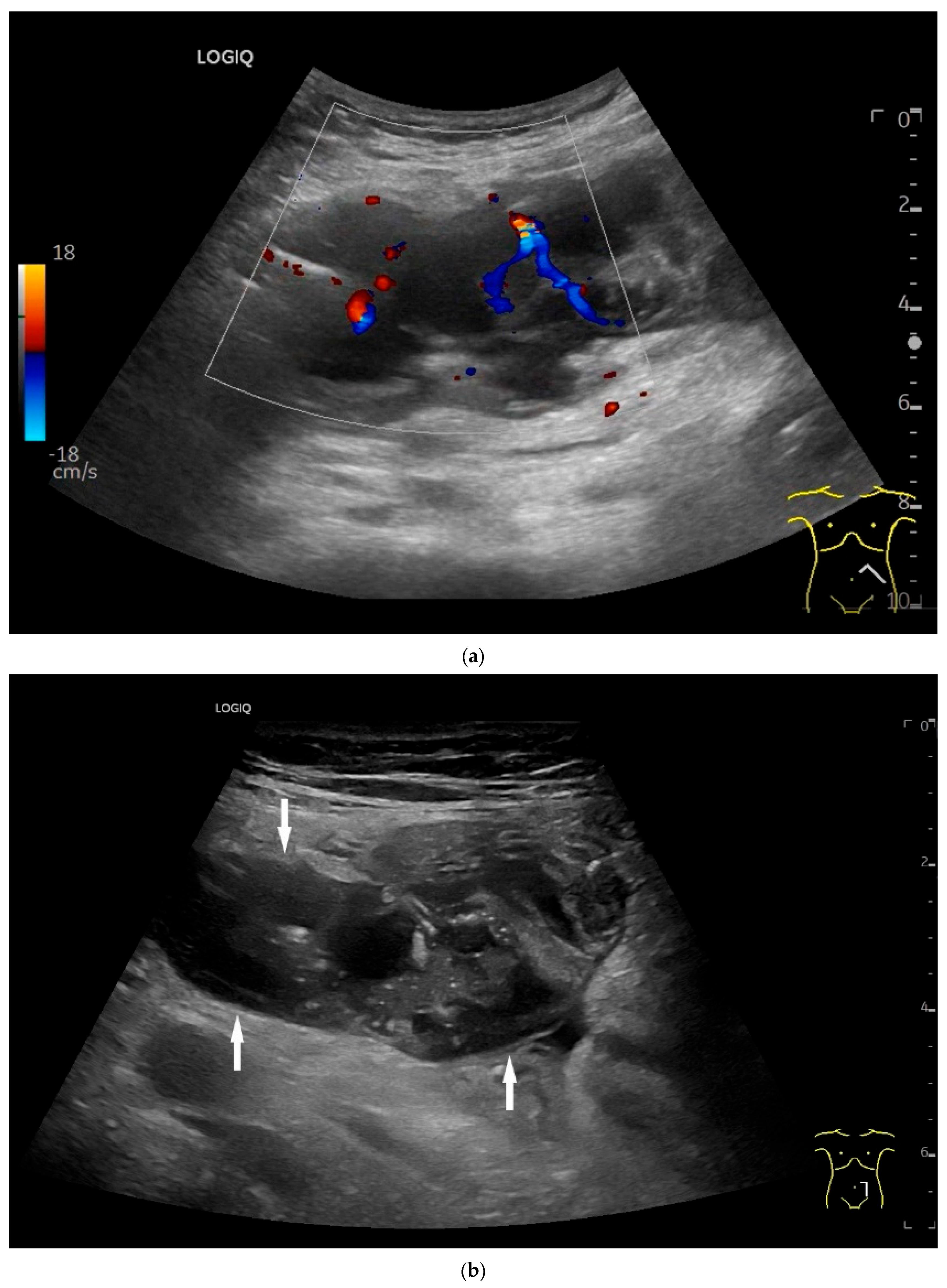 Healthcare 13 02776 g009a Healthcare 13 02776 g009a