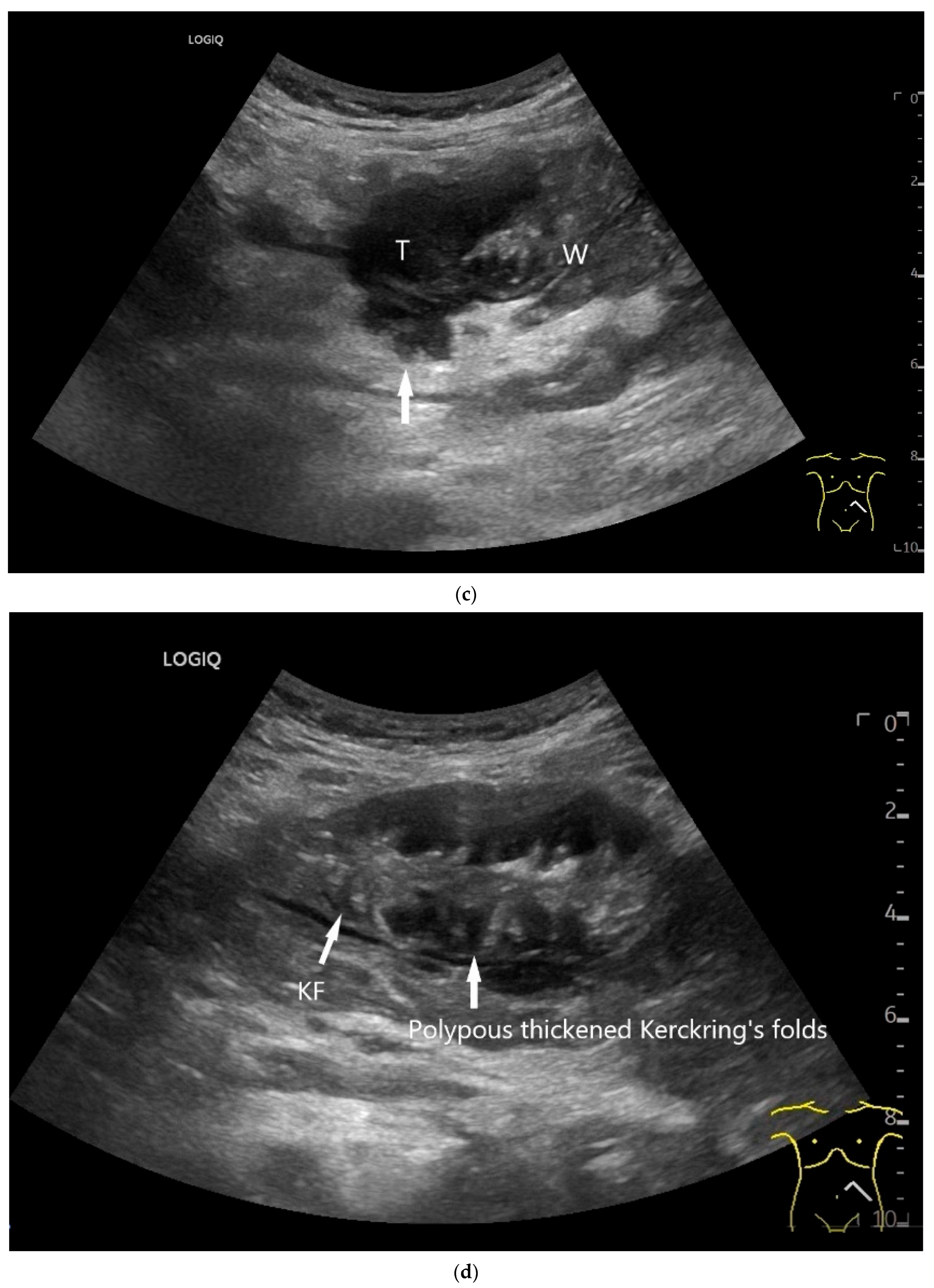 Healthcare 13 02776 g009b Healthcare 13 02776 g009b