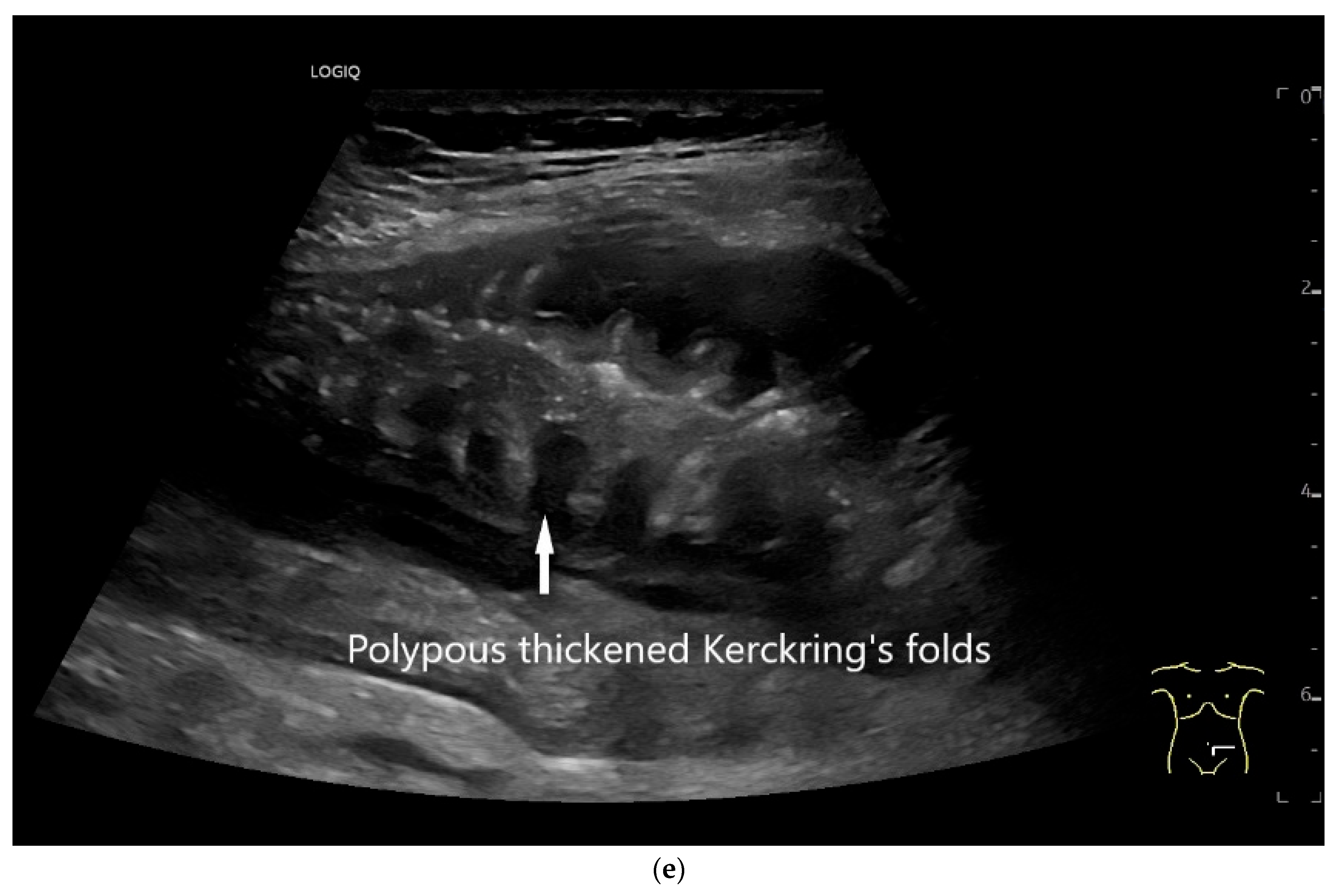 Healthcare 13 02776 g009c Healthcare 13 02776 g009c