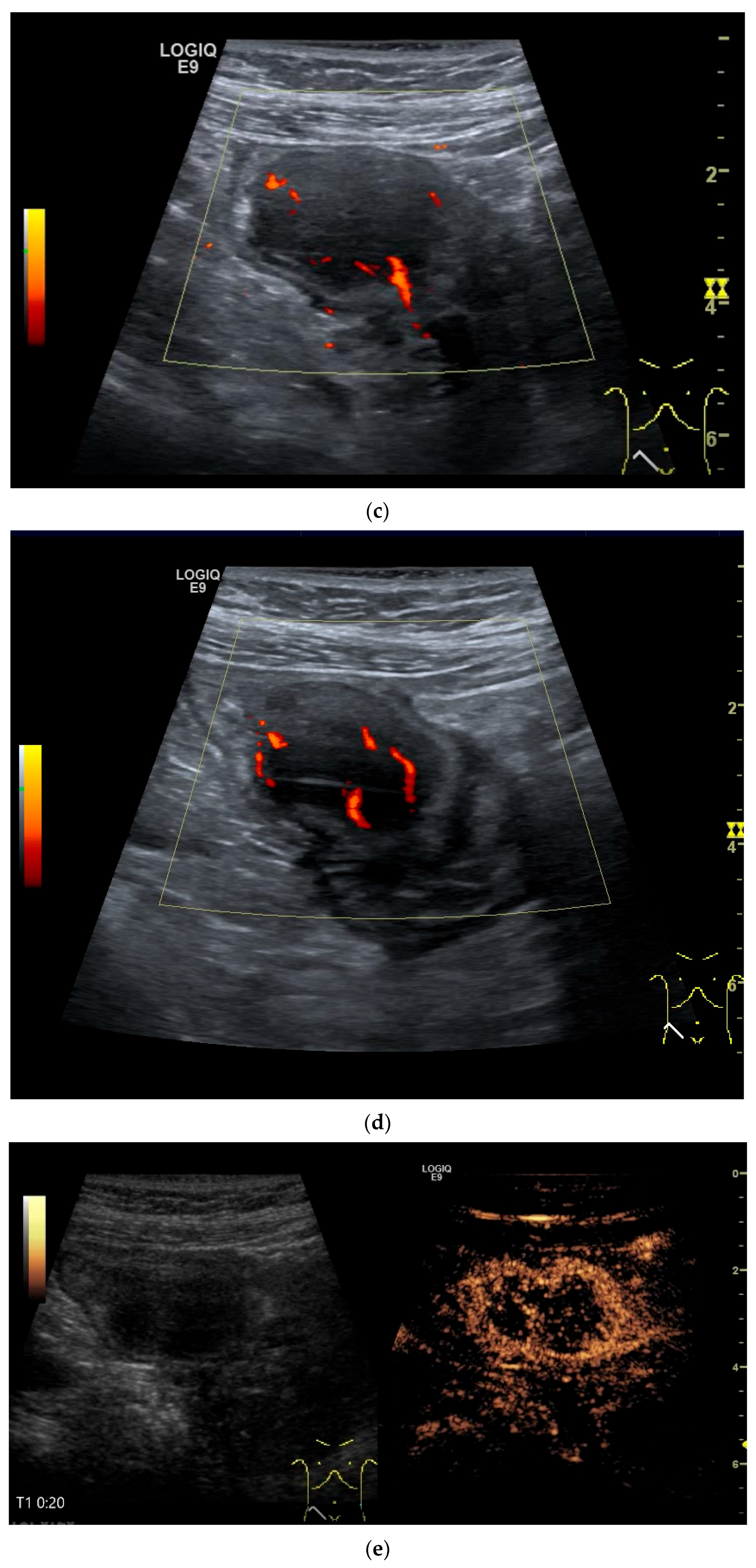 Healthcare 13 02776 g013b Healthcare 13 02776 g013b
