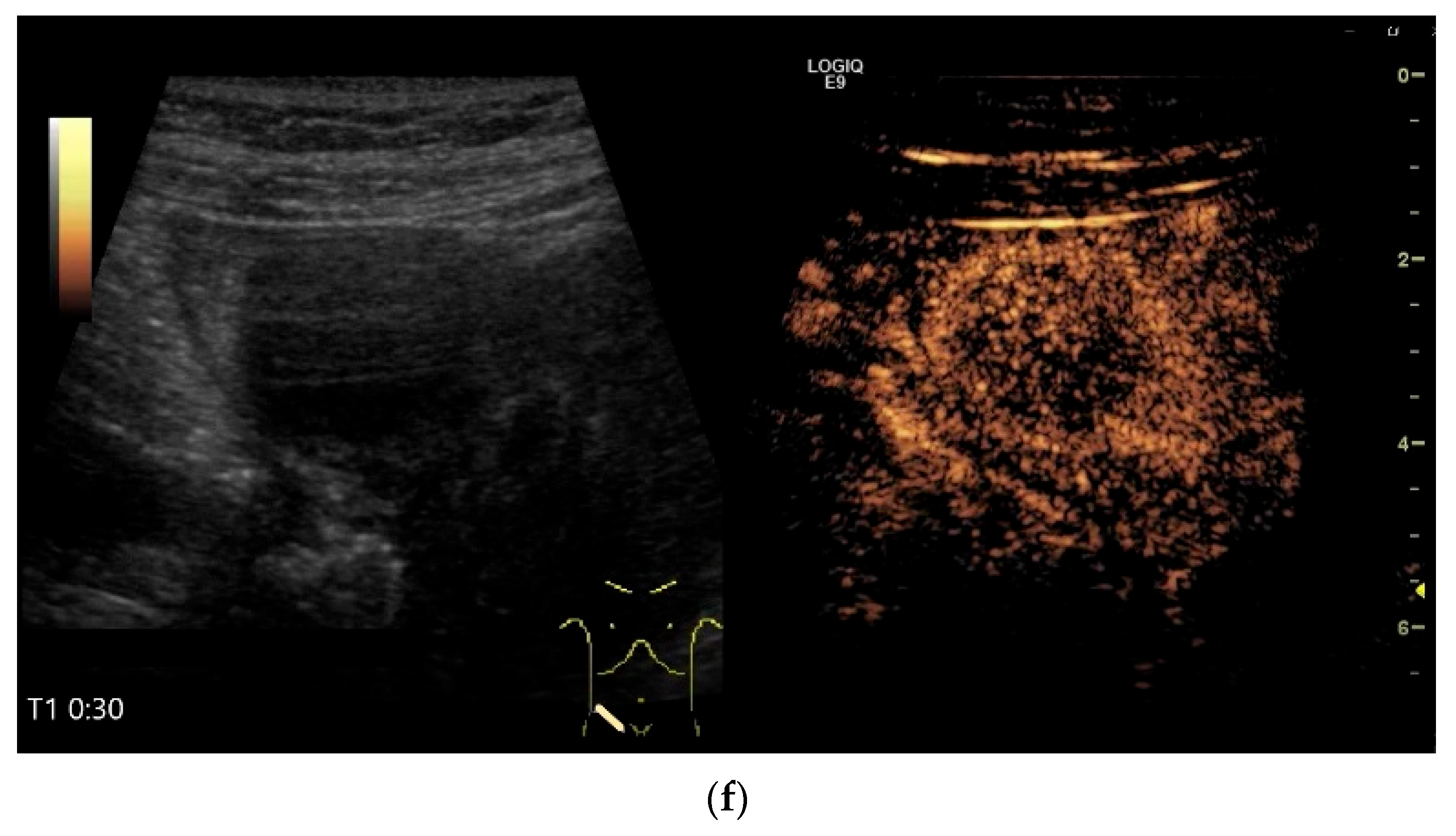 Healthcare 13 02776 g013c Healthcare 13 02776 g013c