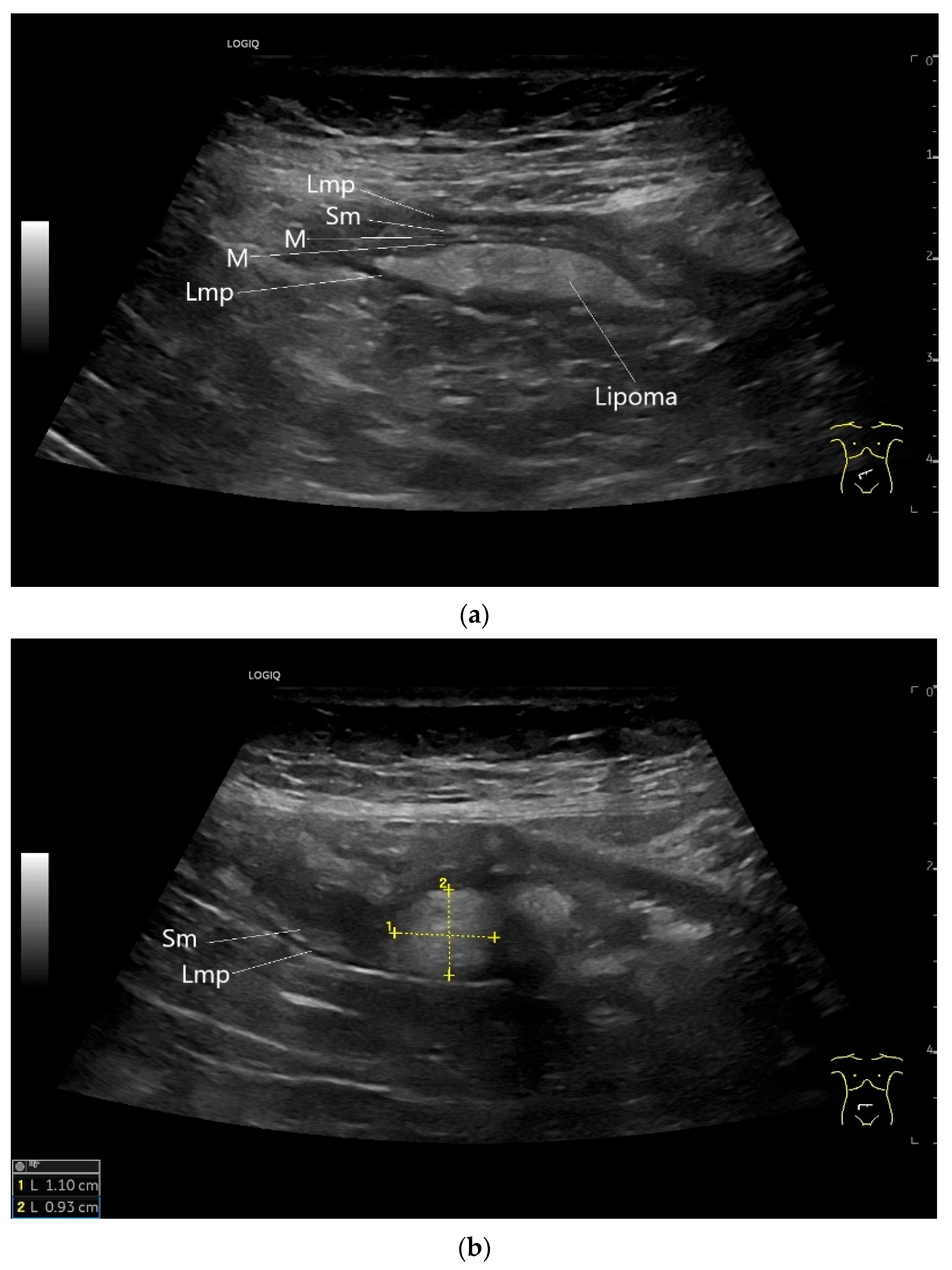 Healthcare 13 02776 g016 Healthcare 13 02776 g016