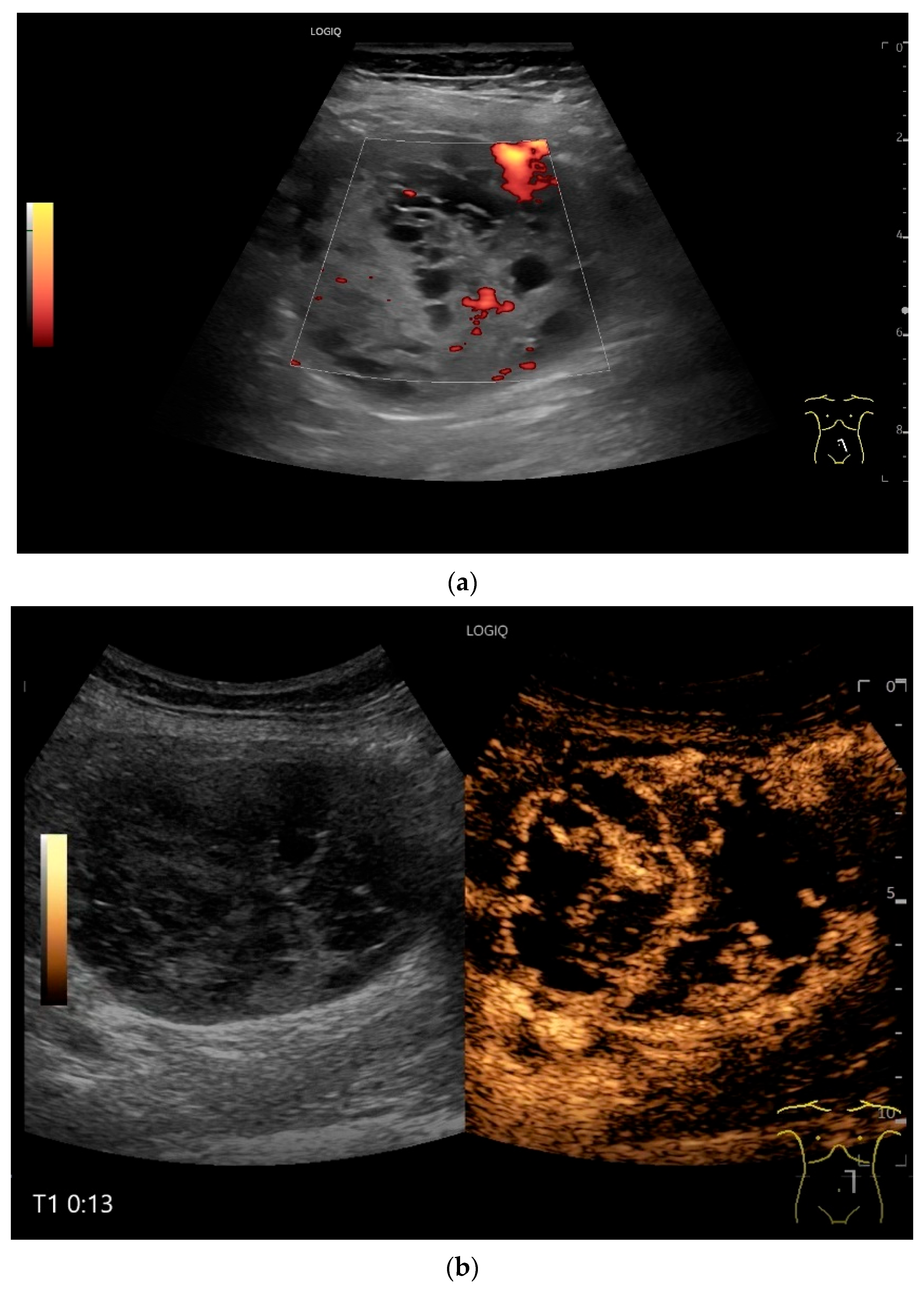 Healthcare 13 02776 g017a Healthcare 13 02776 g017a