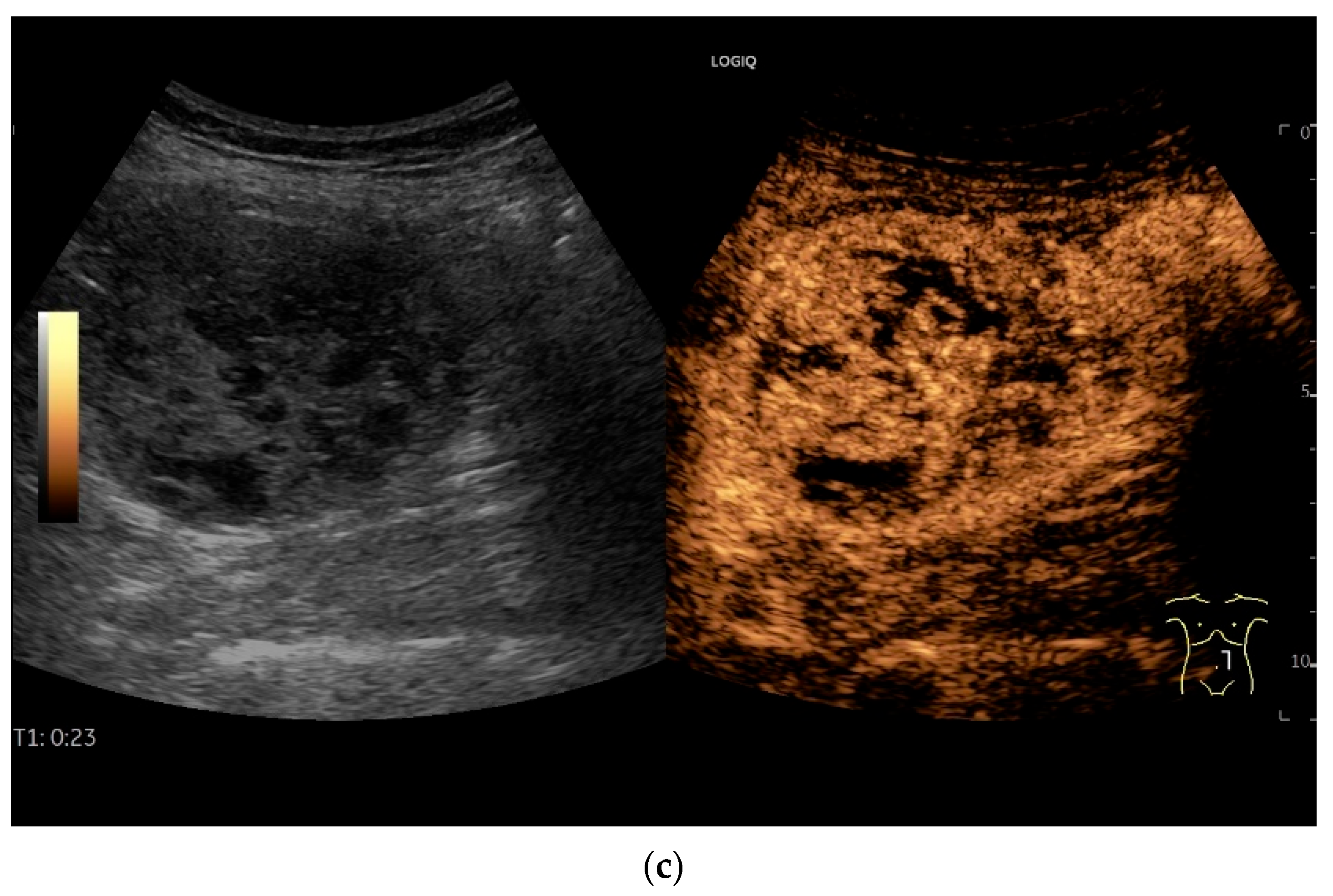 Healthcare 13 02776 g017b Healthcare 13 02776 g017b