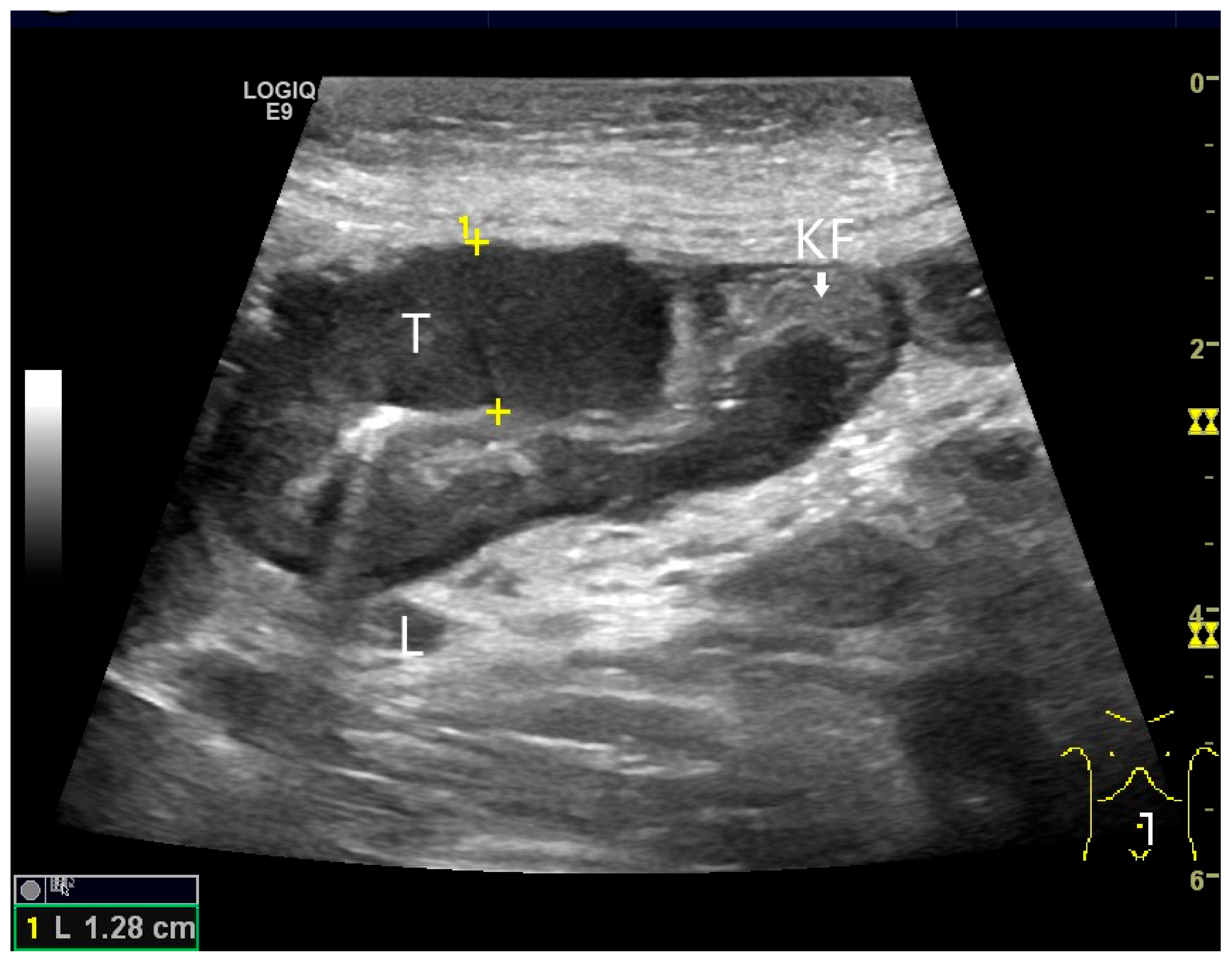 Healthcare 13 02776 g019 Healthcare 13 02776 g019