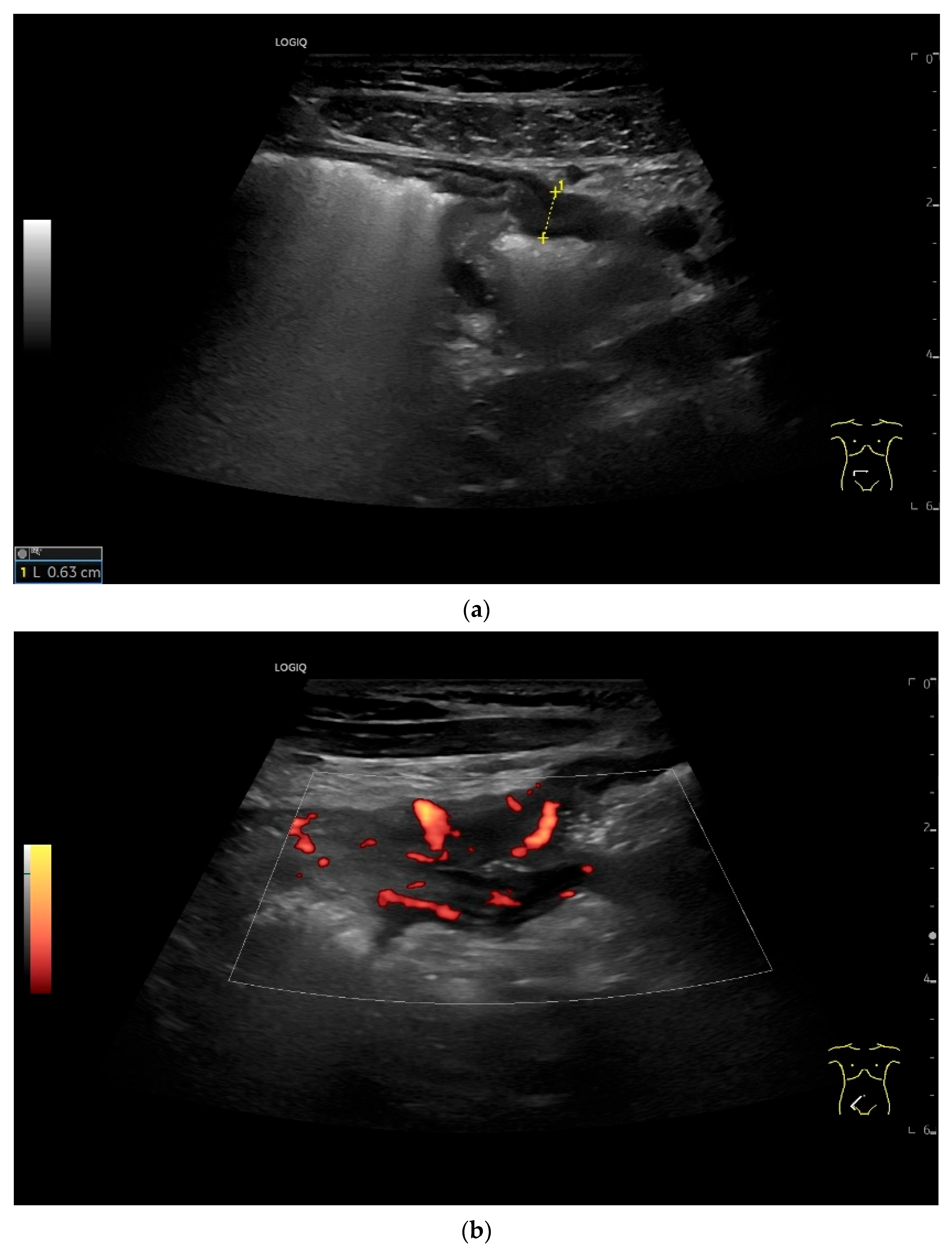 Healthcare 13 02776 g020 Healthcare 13 02776 g020