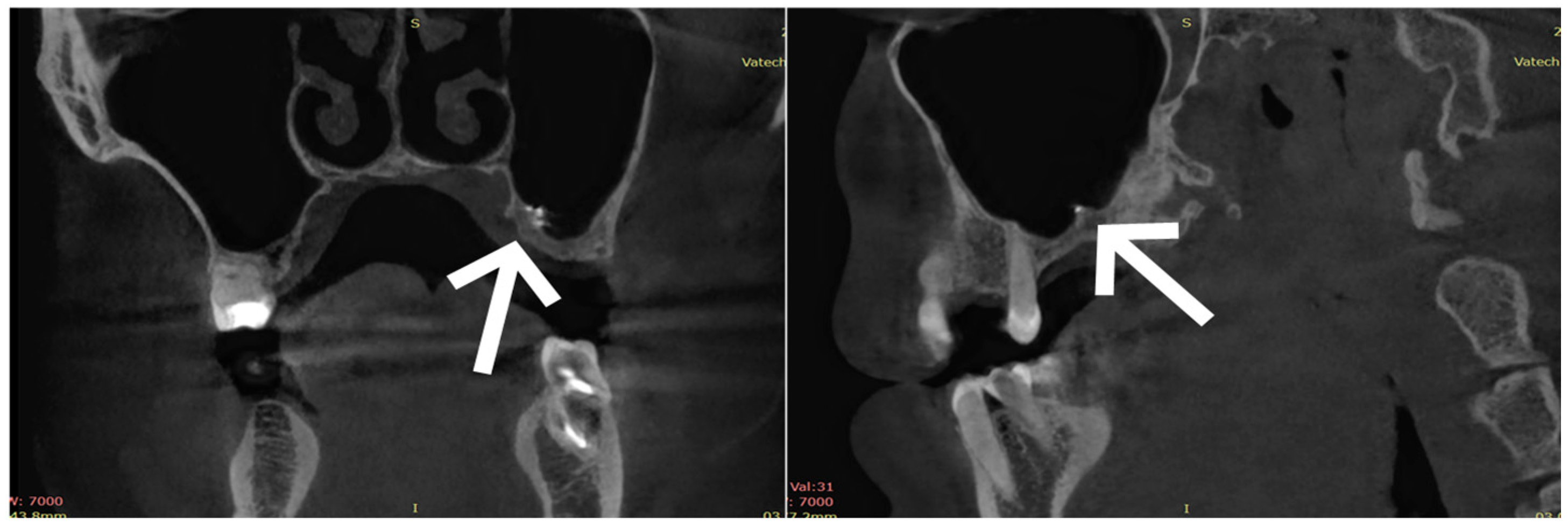 Healthcare 13 03283 g001 Healthcare 13 03283 g001