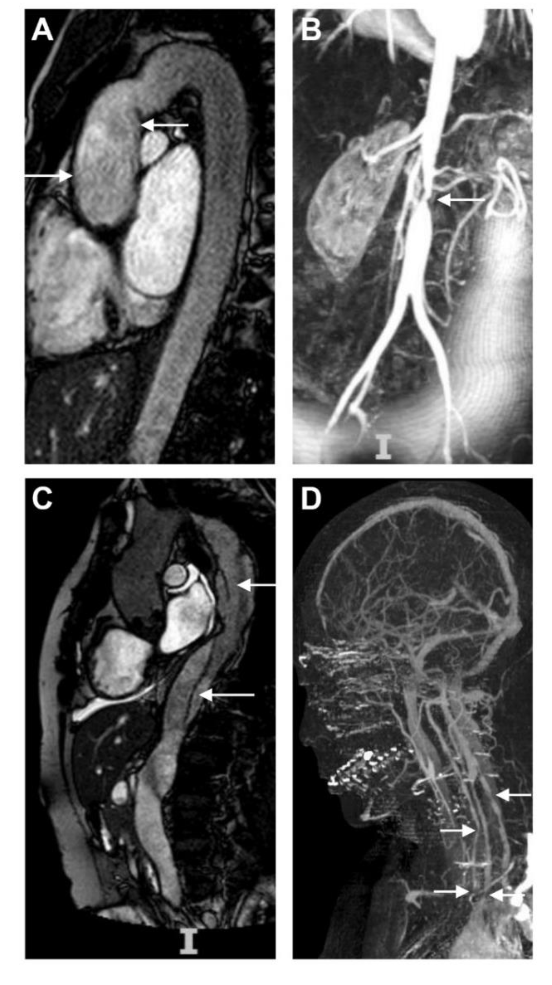 Hearts 01 00008 g002