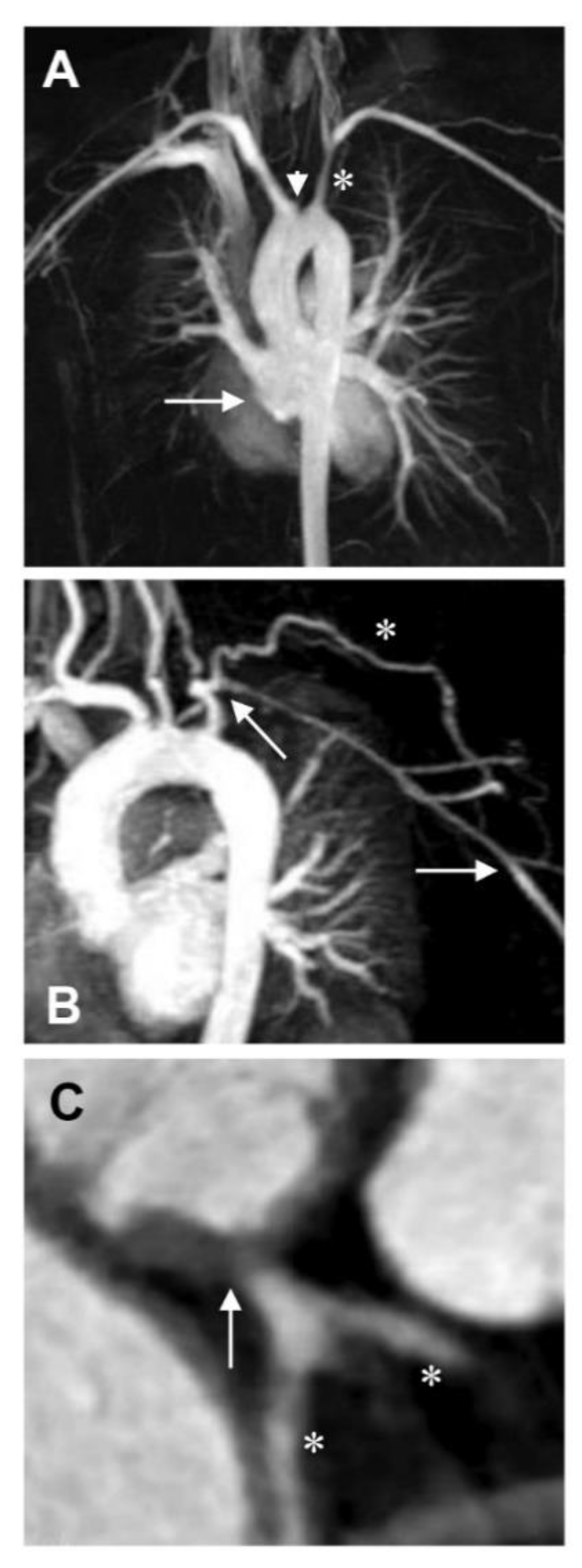 Hearts 01 00008 g003