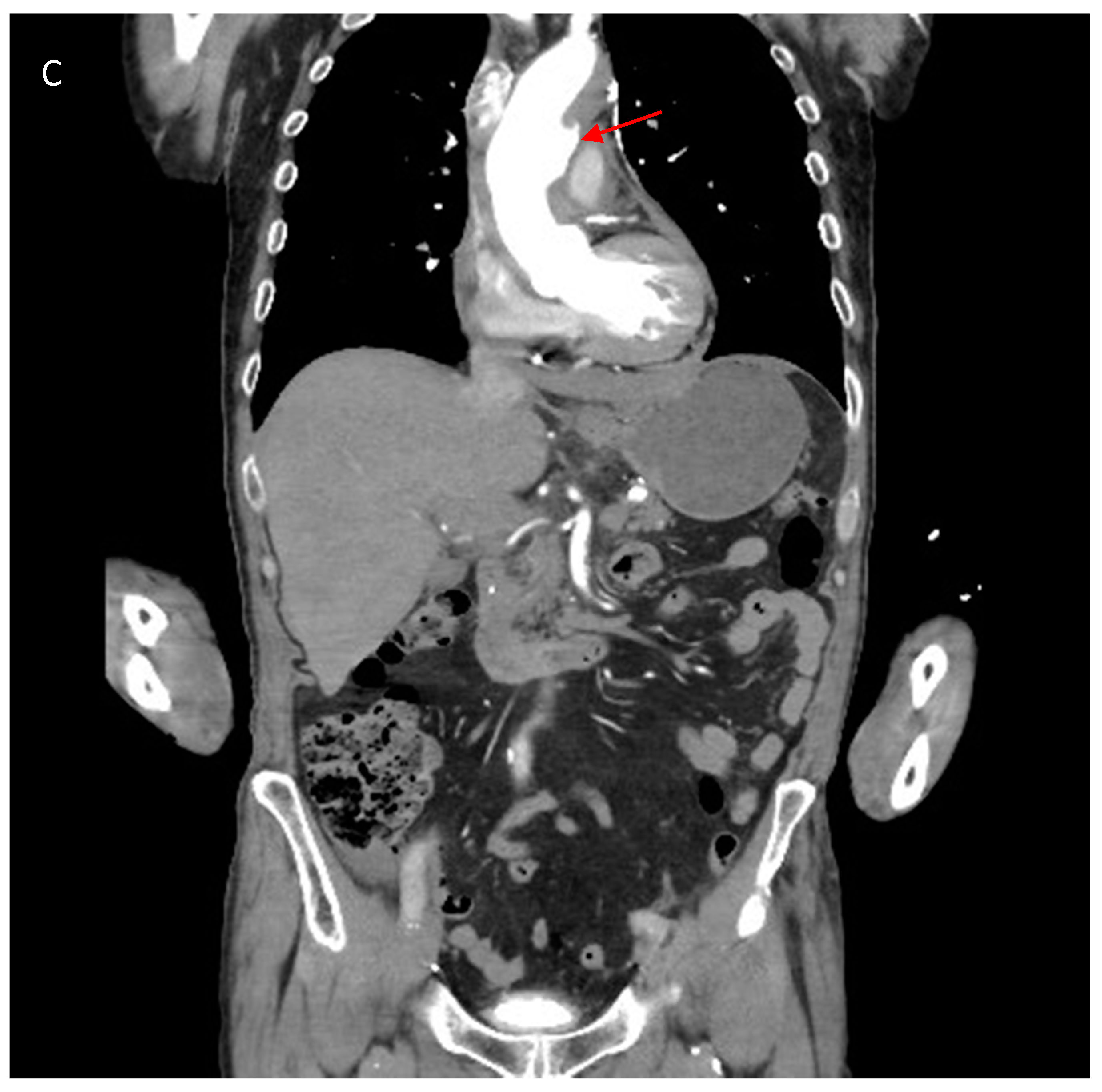 Hearts 01 00009 g001b