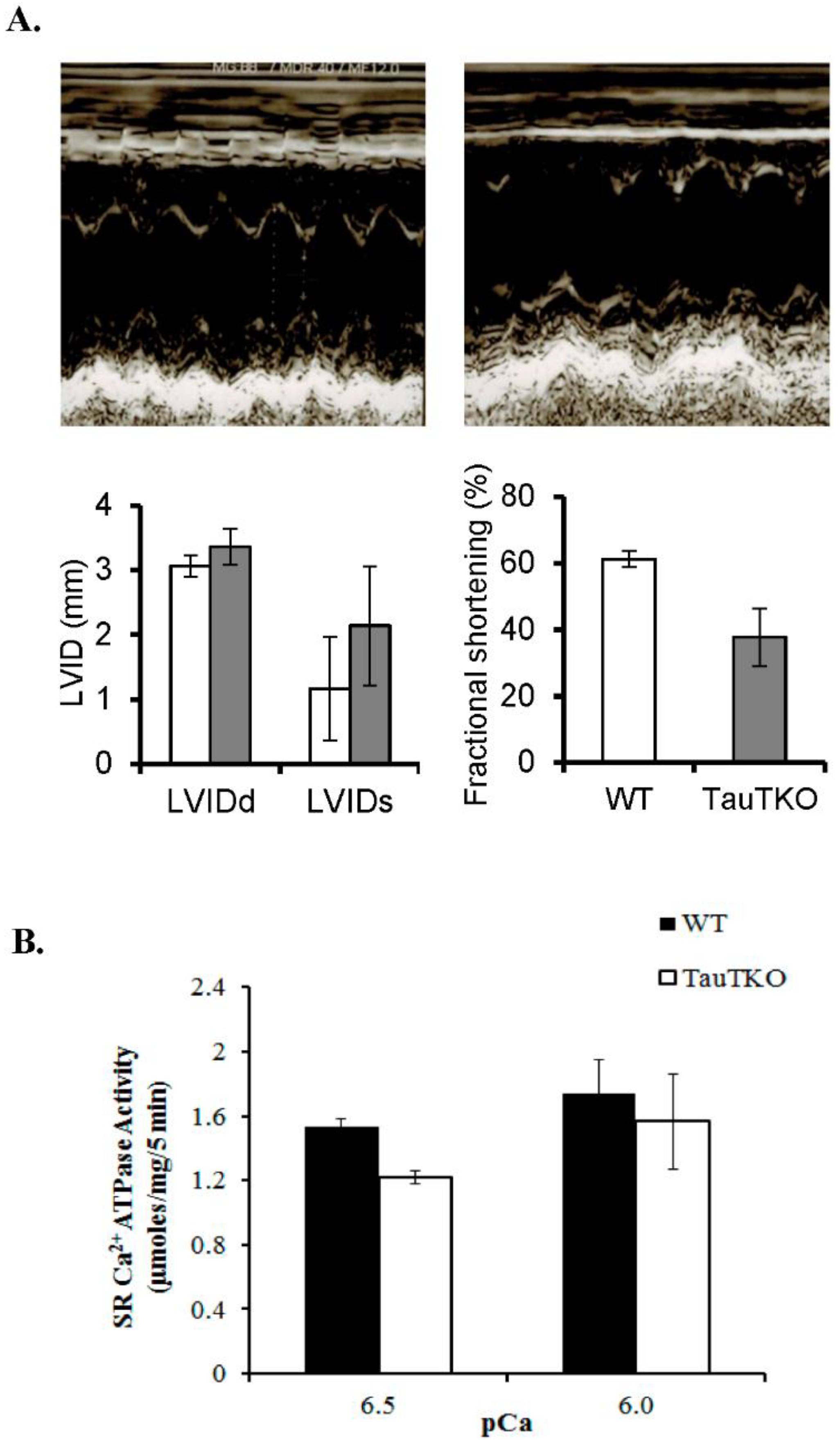 Taurine deficient cardiomyopathy discount