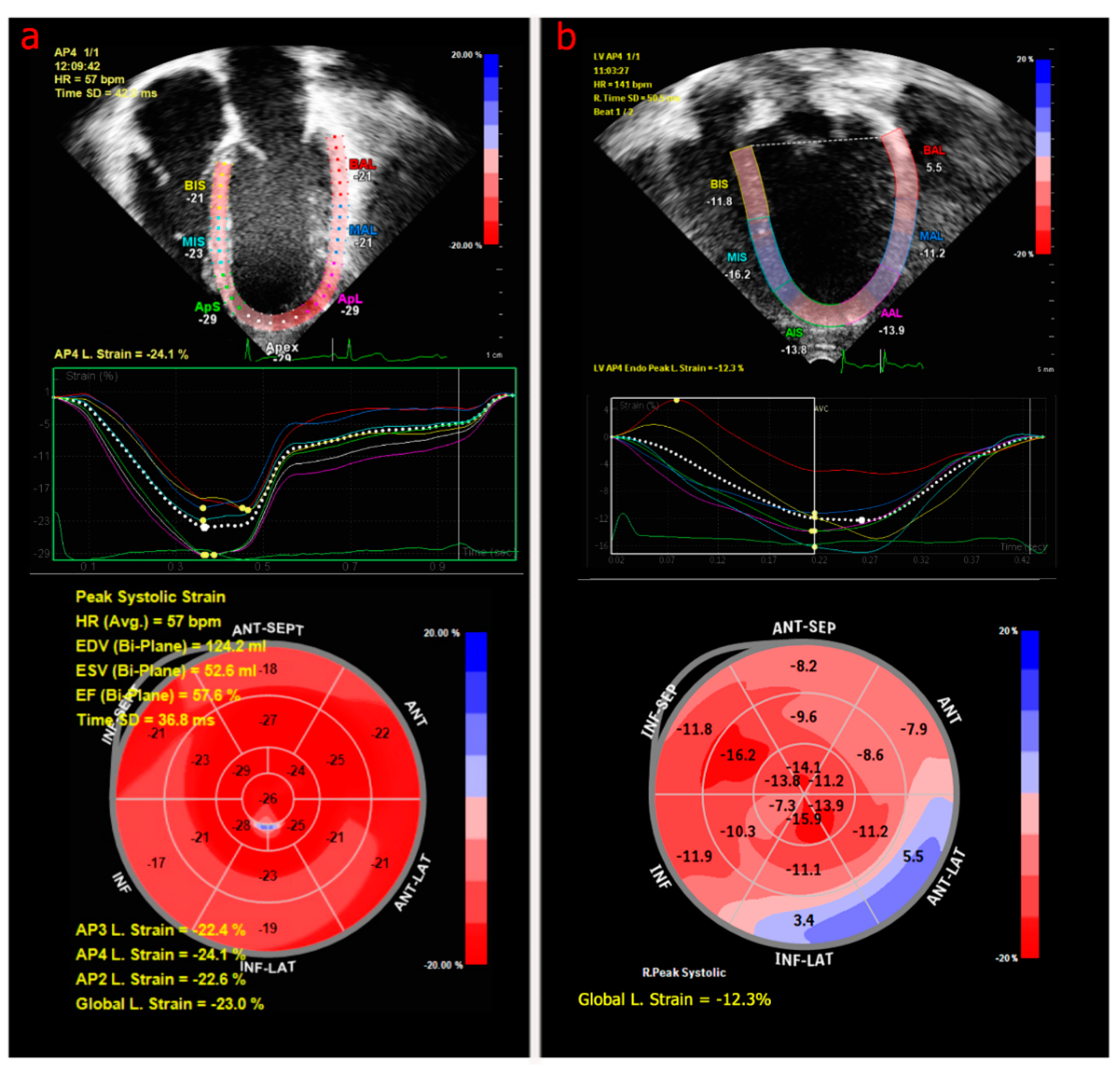 Hearts 02 00005 g001
