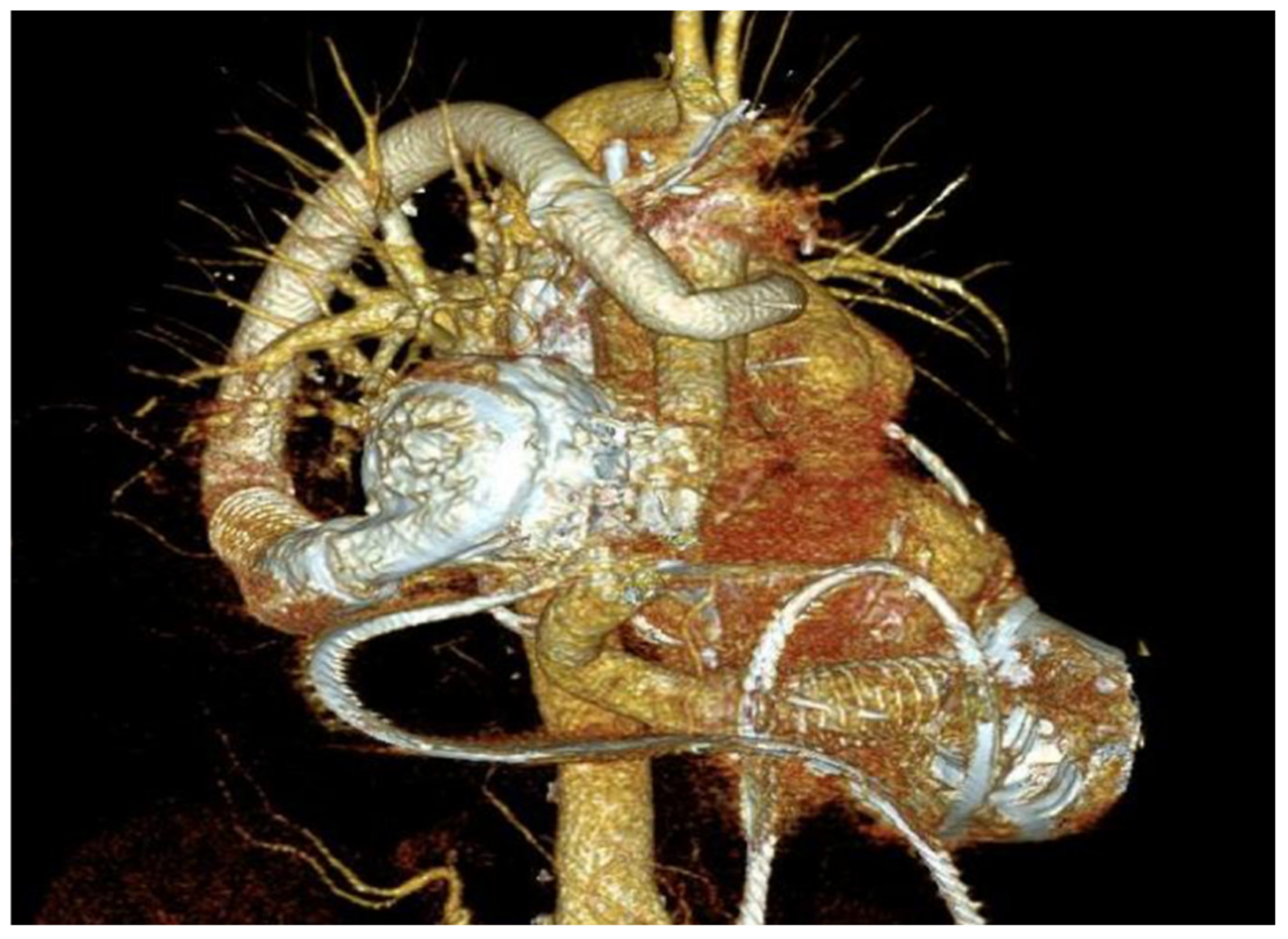 Hearts 02 00010 g003 Hearts 02 00010 g003