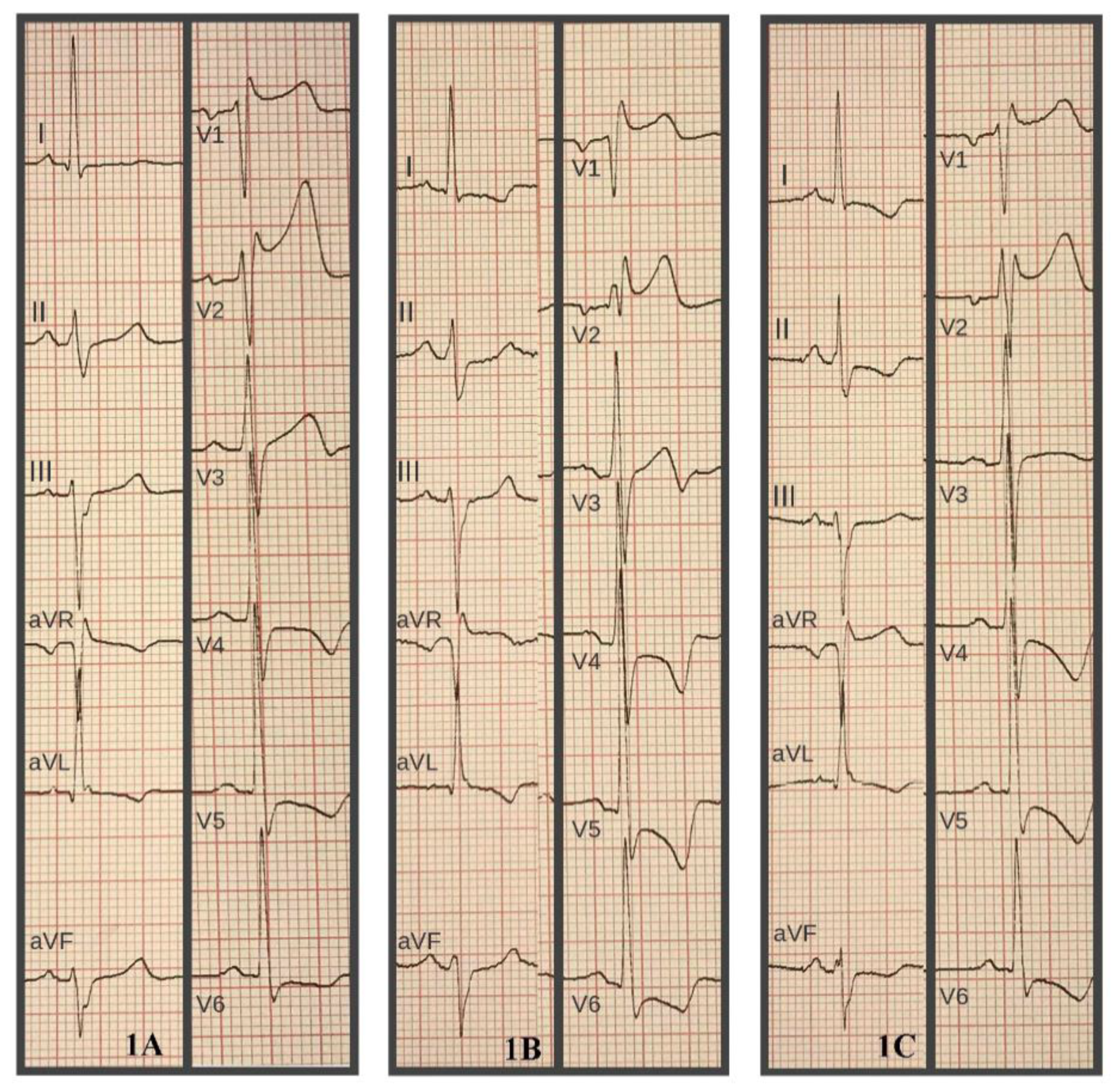 Hearts 02 00030 g001 Hearts 02 00030 g001