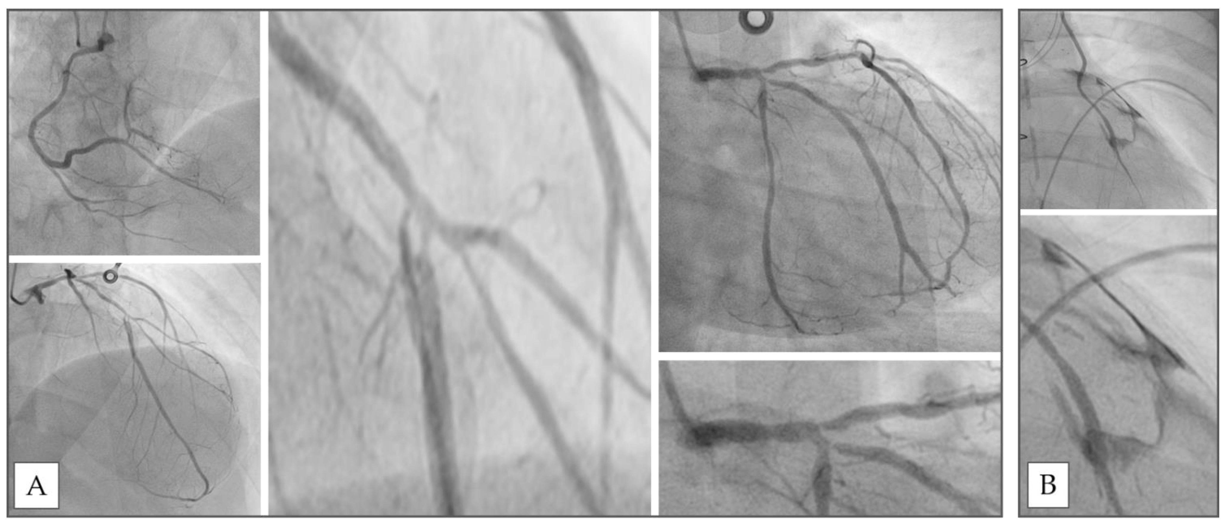 Hearts 02 00030 g002 Hearts 02 00030 g002