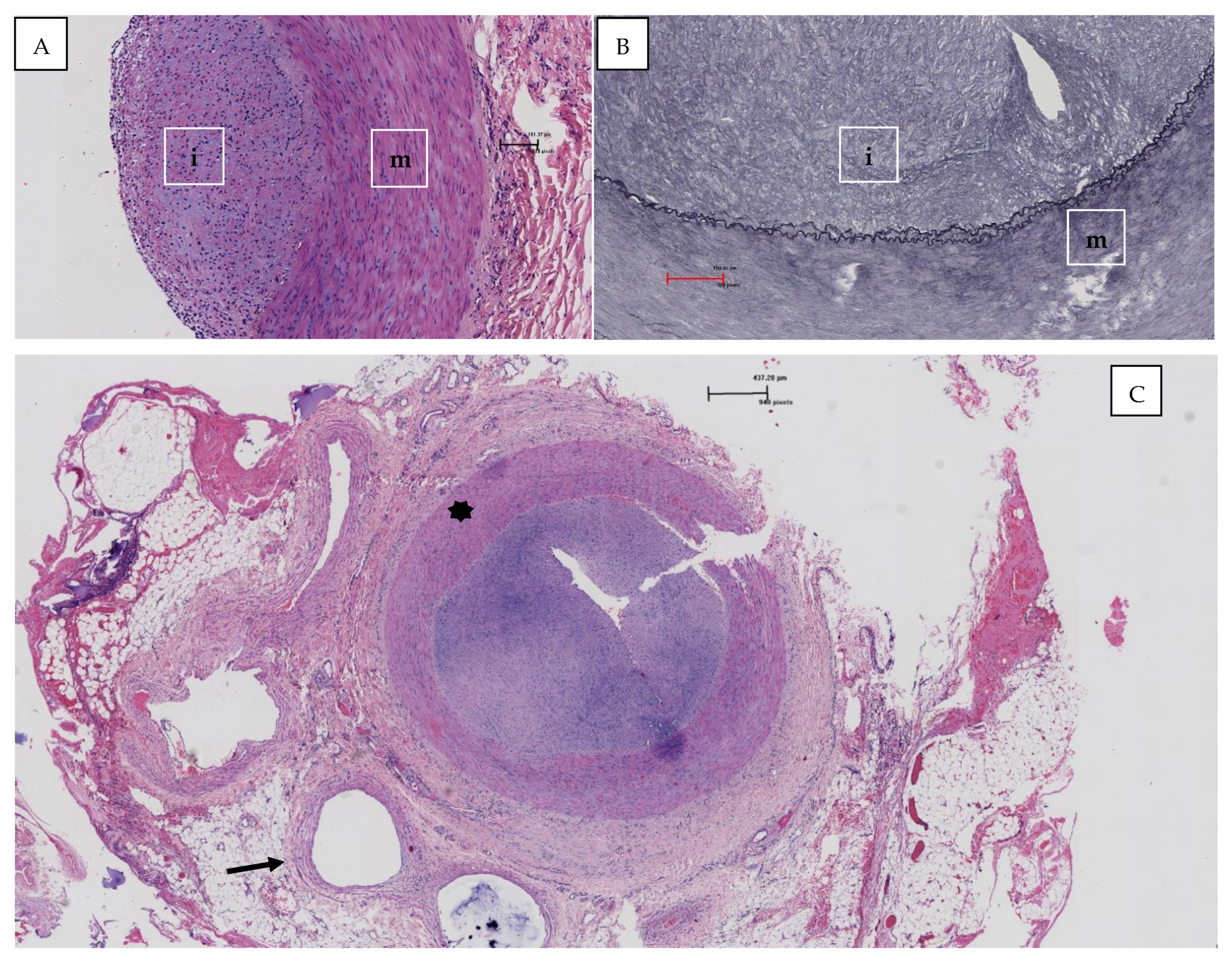 Hearts 02 00030 g003 Hearts 02 00030 g003