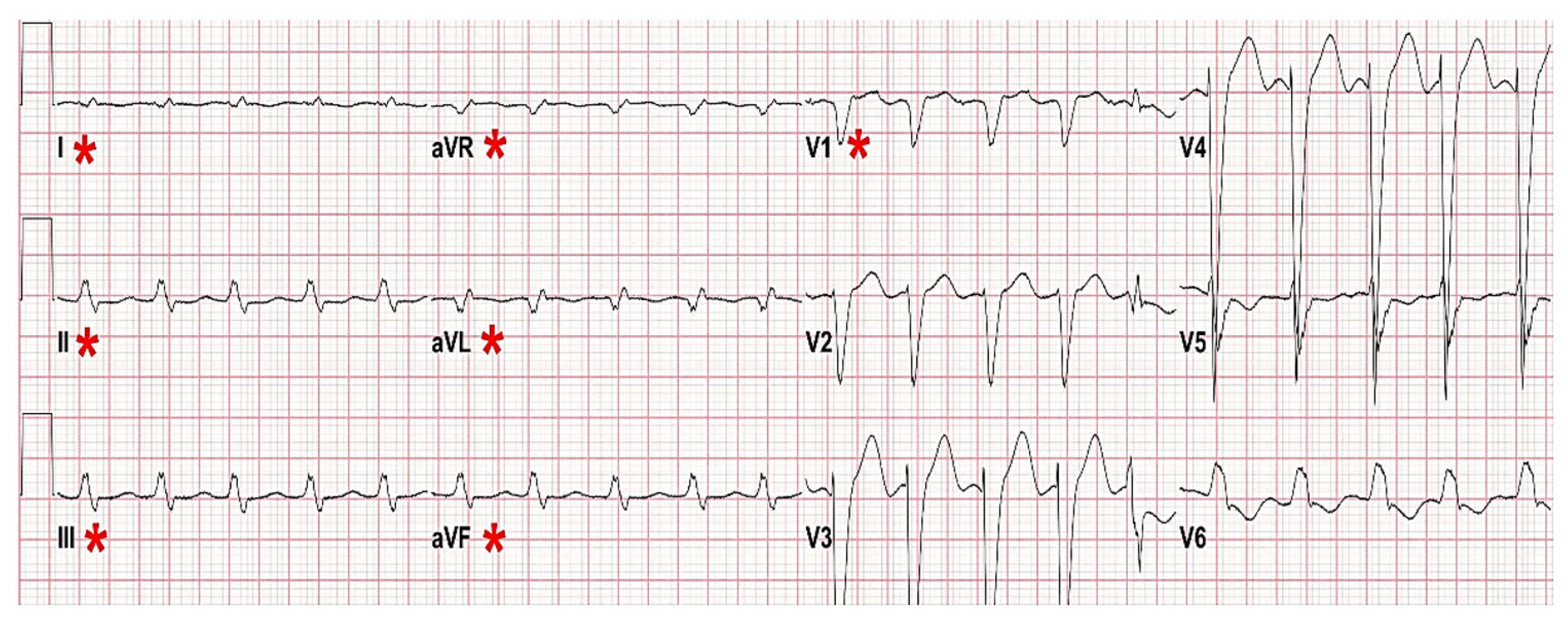 Hearts 02 00036 g004
