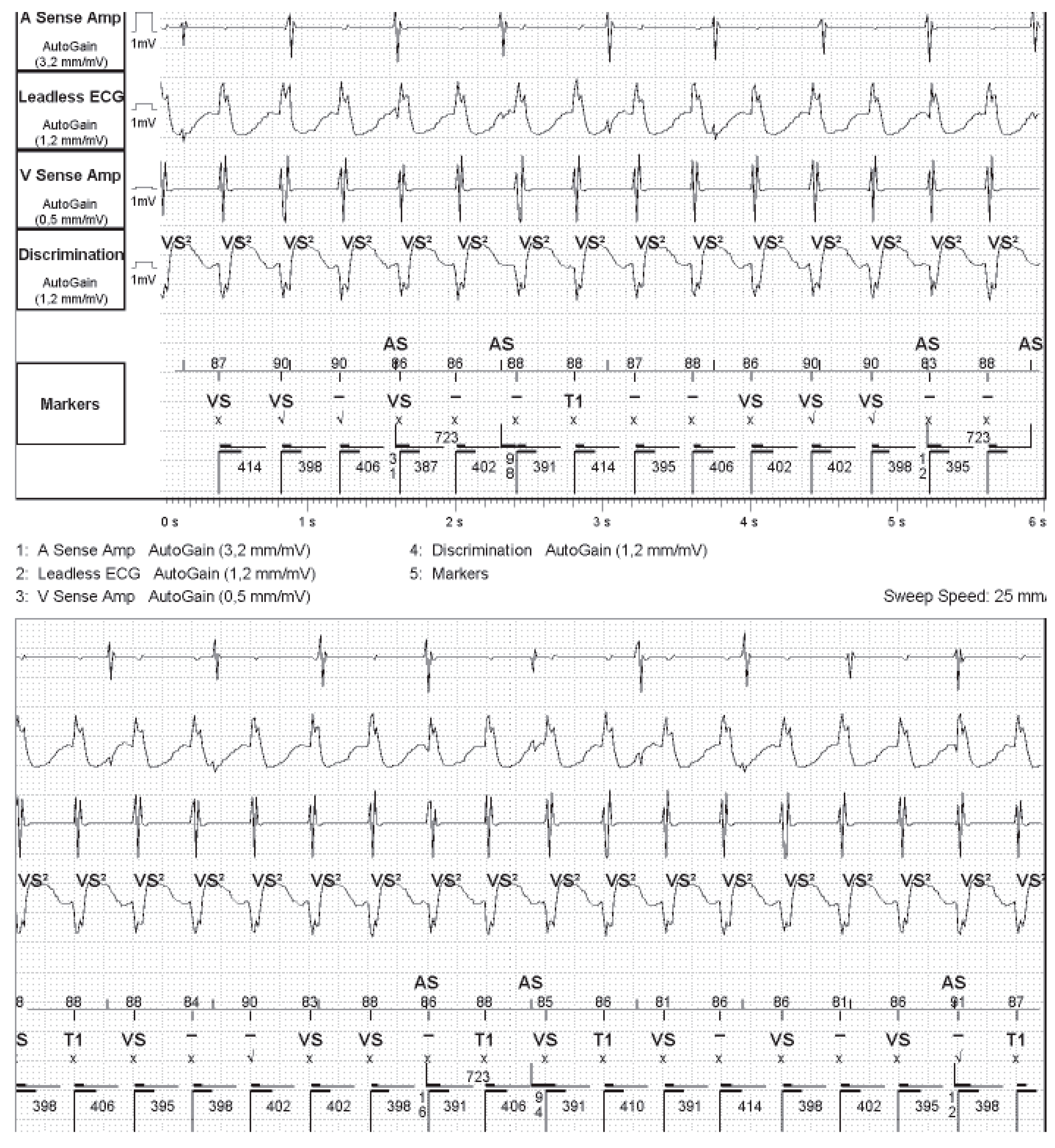 Hearts 02 00044 g002 550